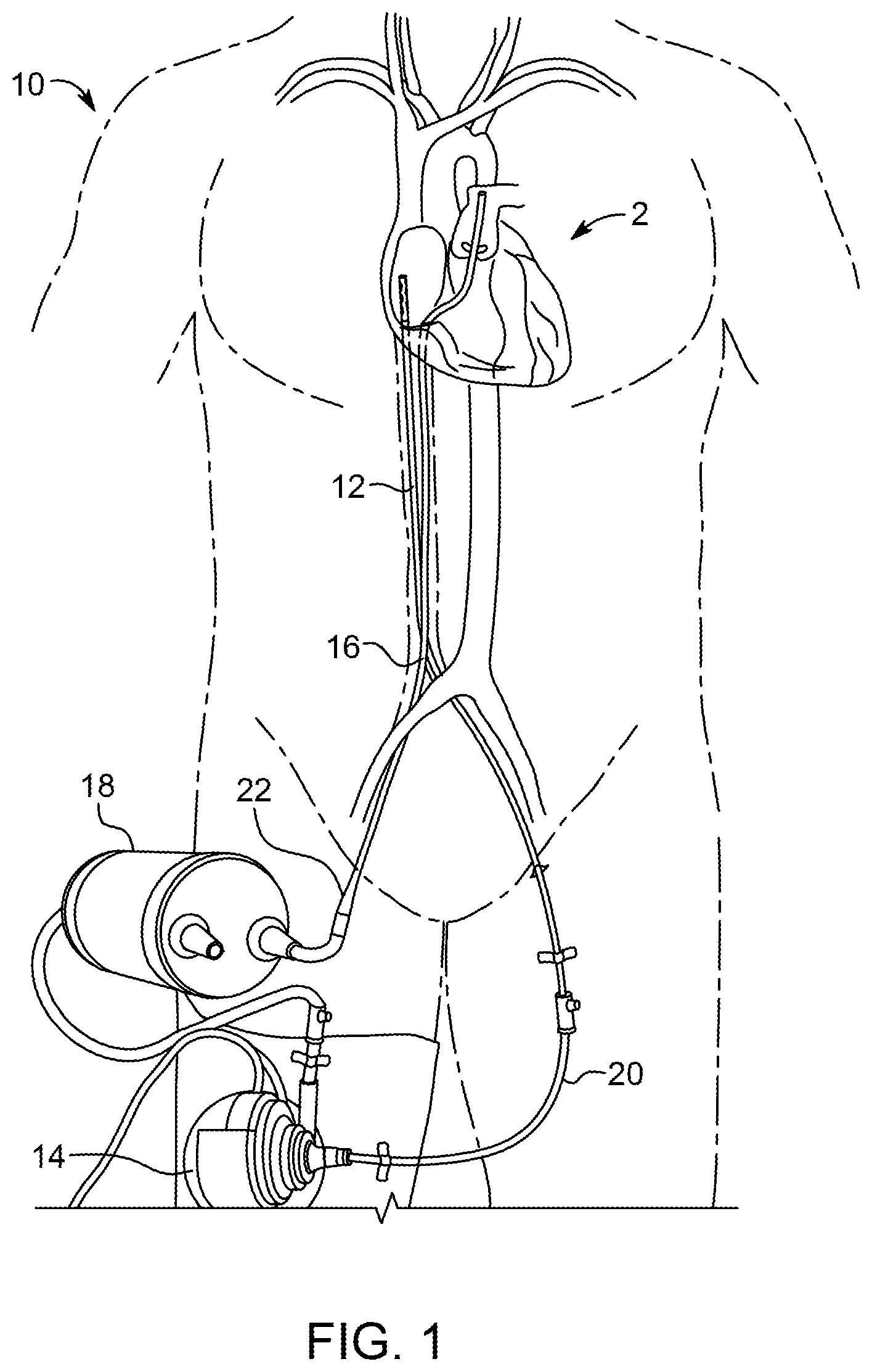 Patent US11793918 — Priming tray for priming a fluid system — Figure 1