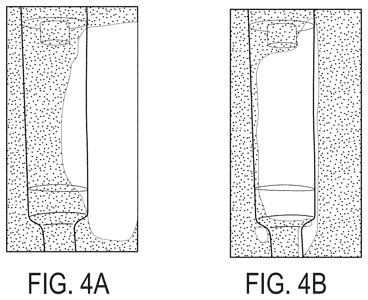 Patent US11793928 Figure 4 – Flow meter and related method