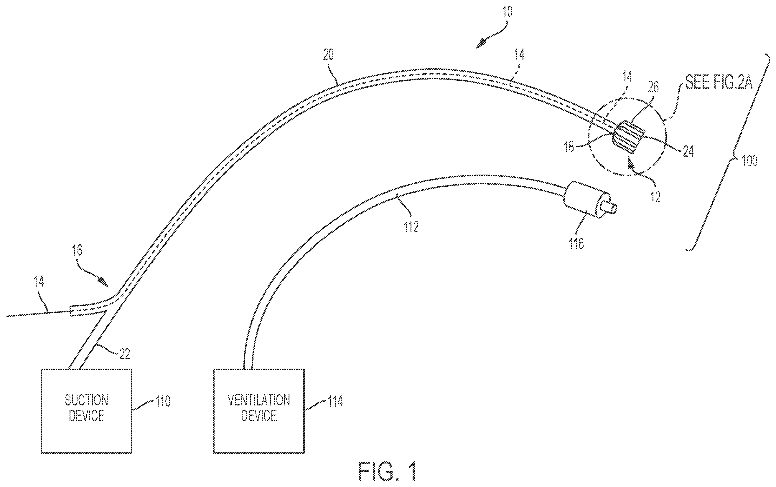 Patent US11793961 — Esophageal temporary occlusion device and method for endotracheal intubation and orogastric tube insertion — Figure 1