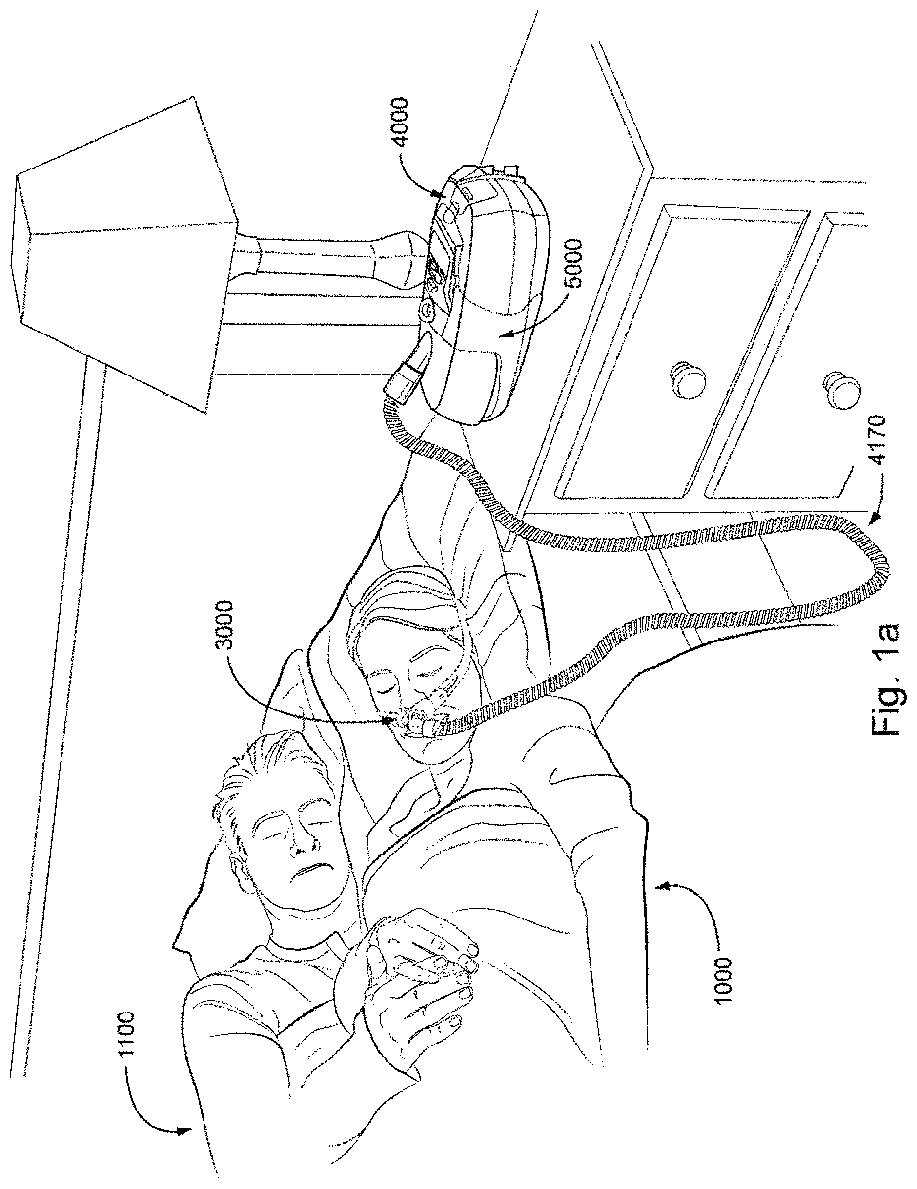 Patent US11793969 — Vent arrangement for a respiratory device — Figure 1