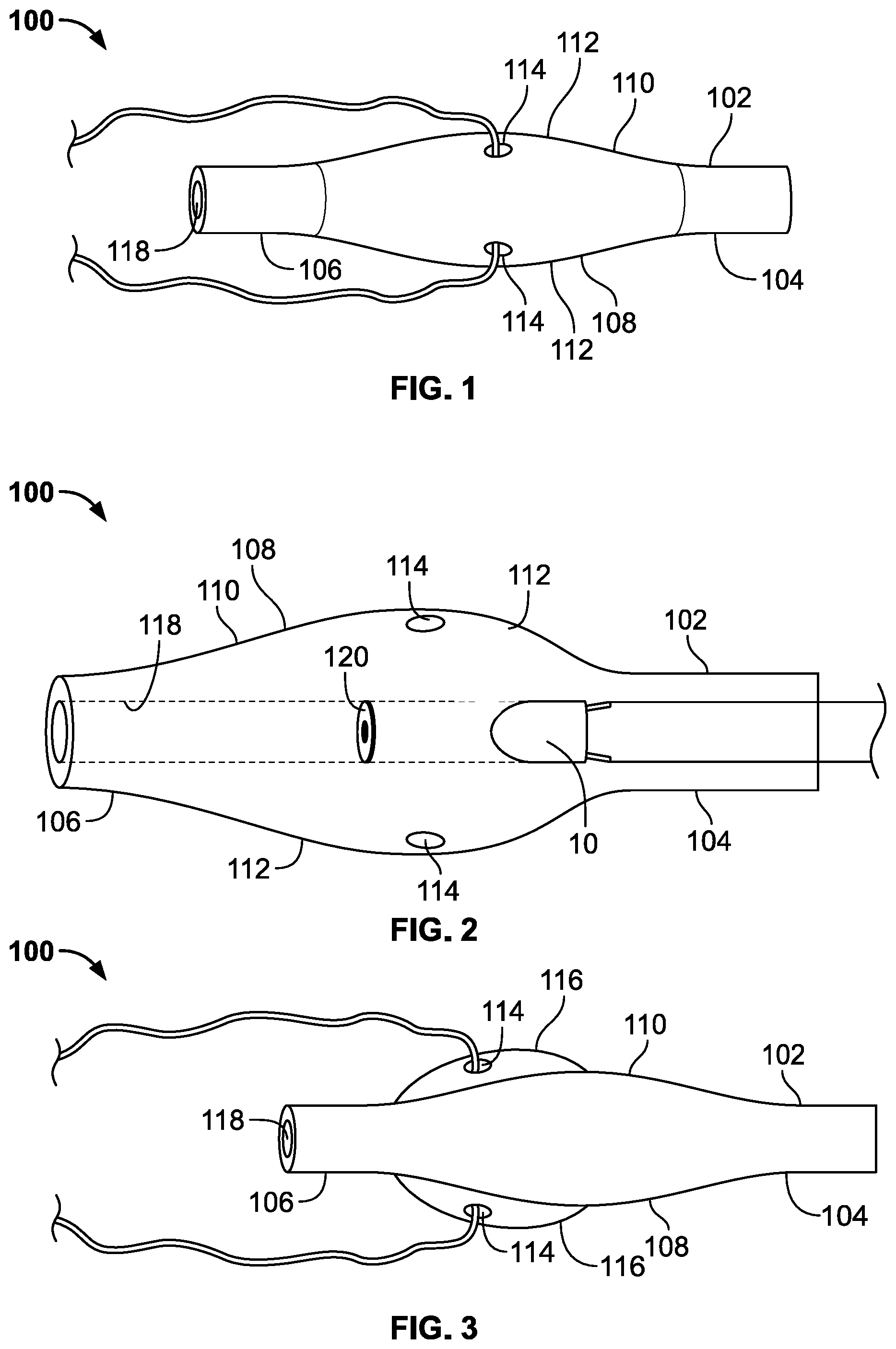 Patent US11793974 — Fixation devices for catheters — Figure 1