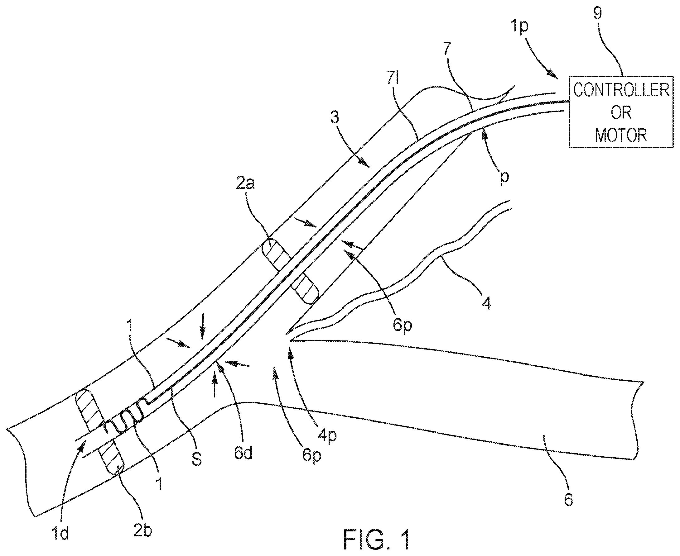 Patent US11793995 — Systems and methods for reducing pressure at an outflow of a duct — Figure 1