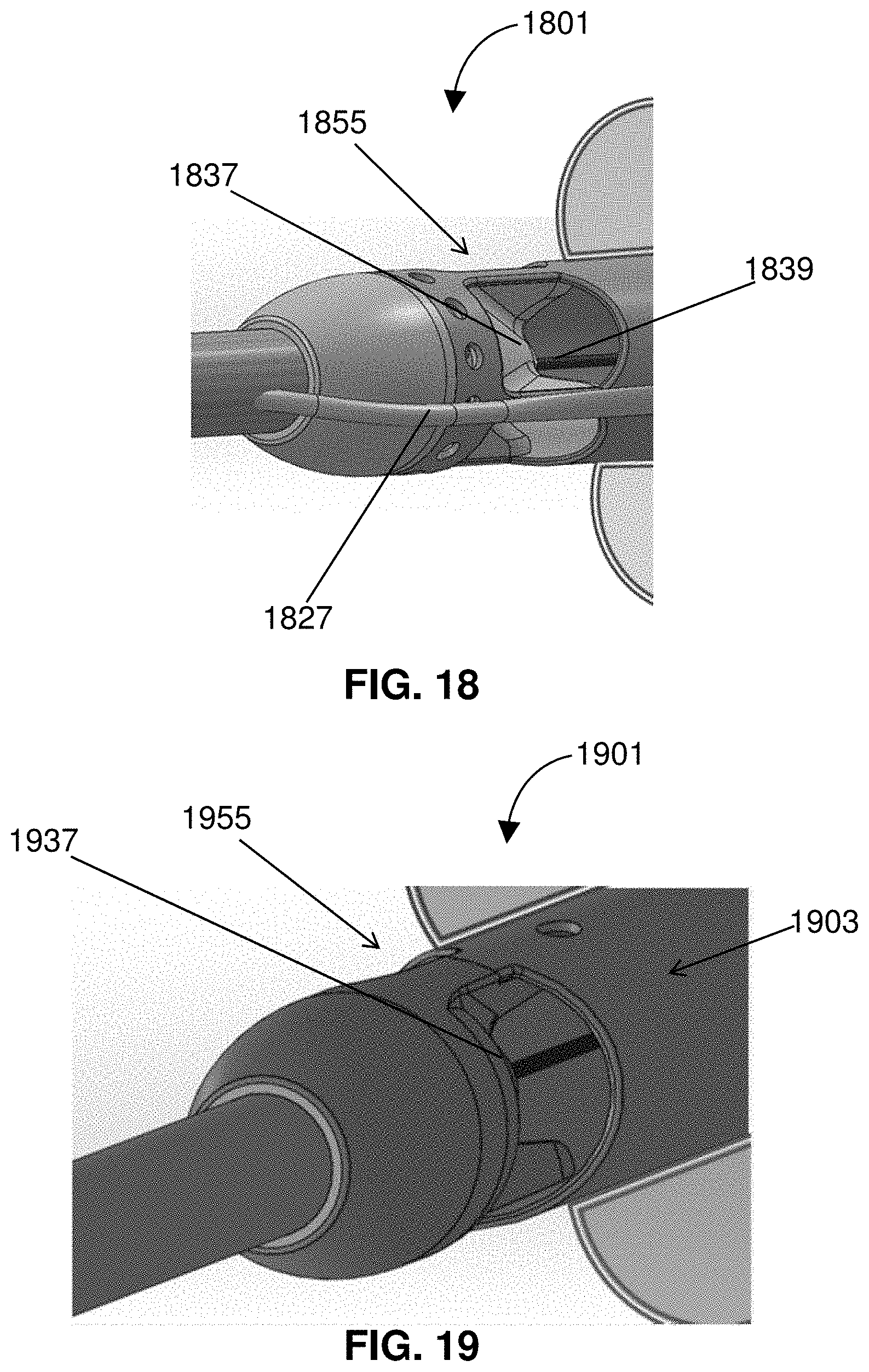 Patent US11793996 Figure 17 – Devices and methods for treating edema