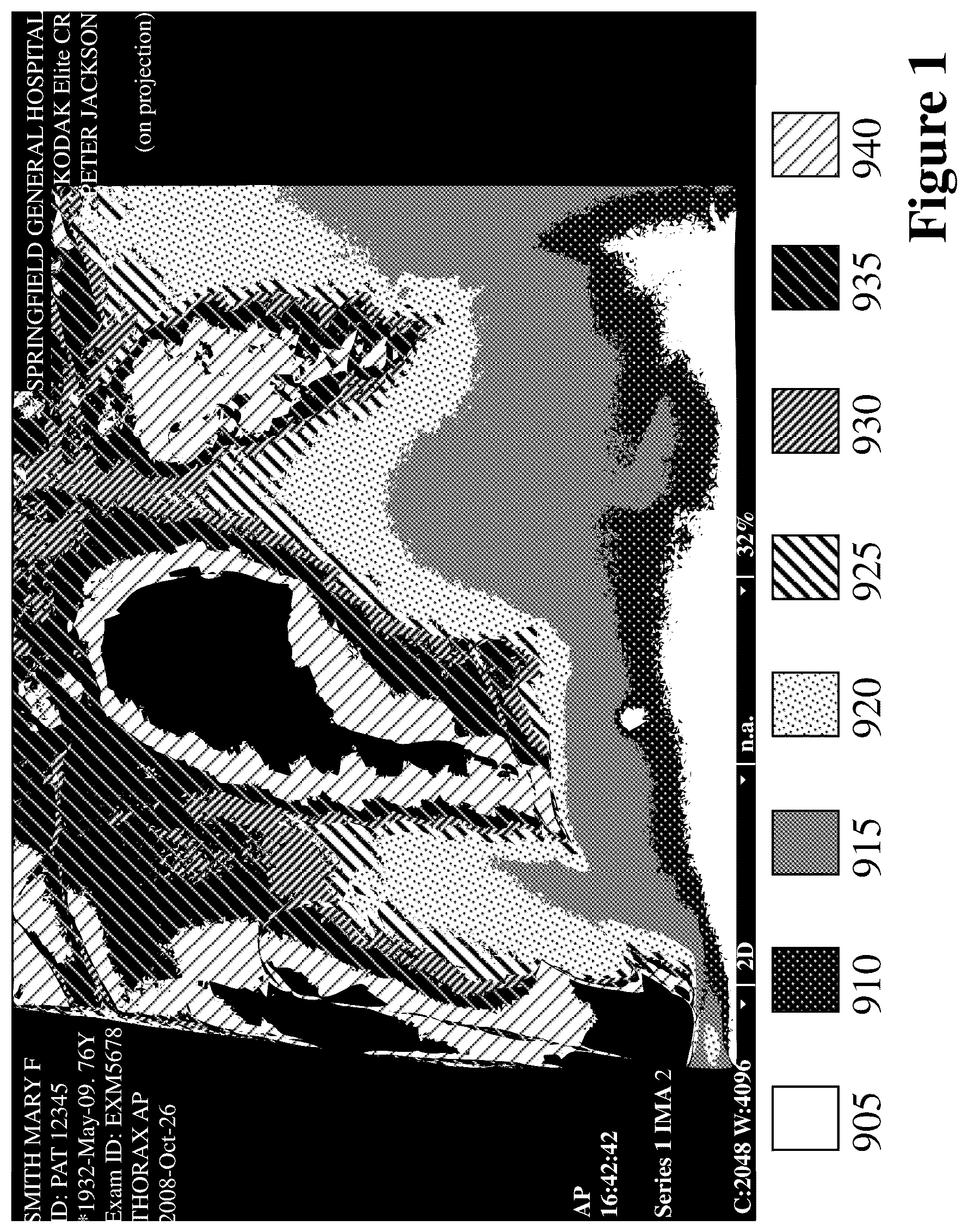 Patent US11810660 — Method and system for rule-based anonymized display and data export — Figure 1
