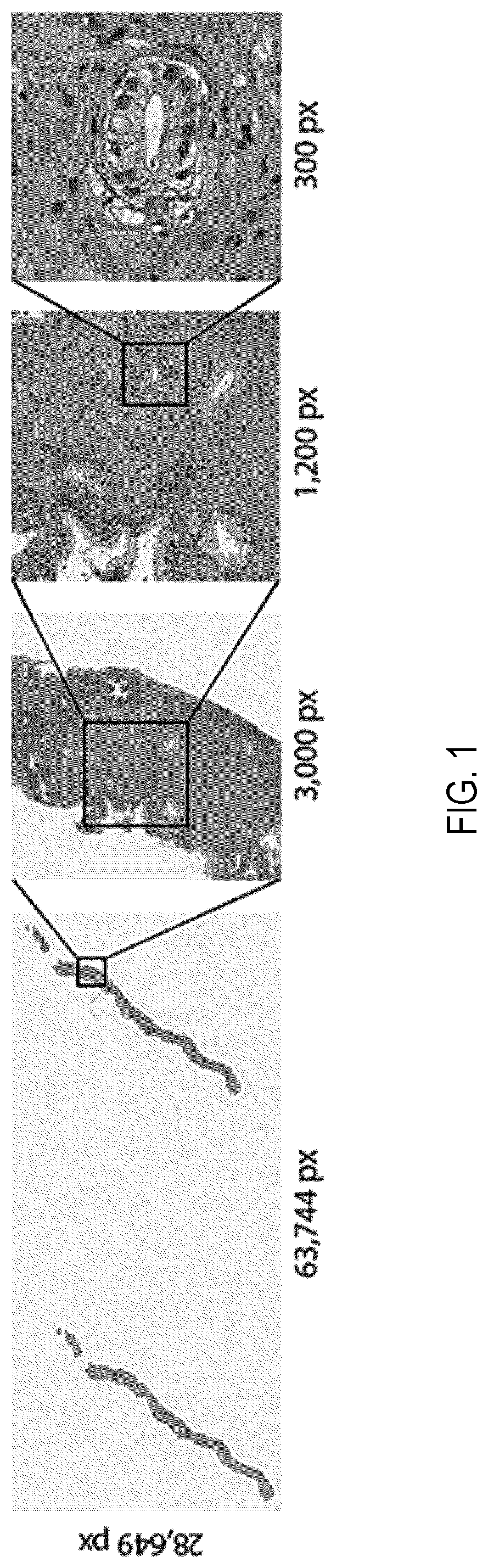 Patent US11810677 — Systems and methods for multiple instance learning for classification and localization in biomedical imaging — Figure 1