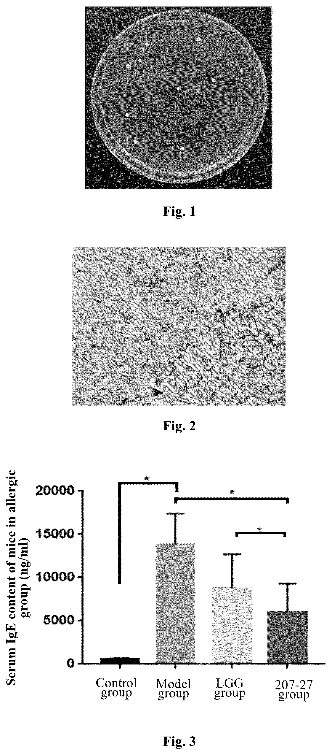 Patent US11812770 — Lactobacillus paracasei 207-27 and use thereof — Figure 1