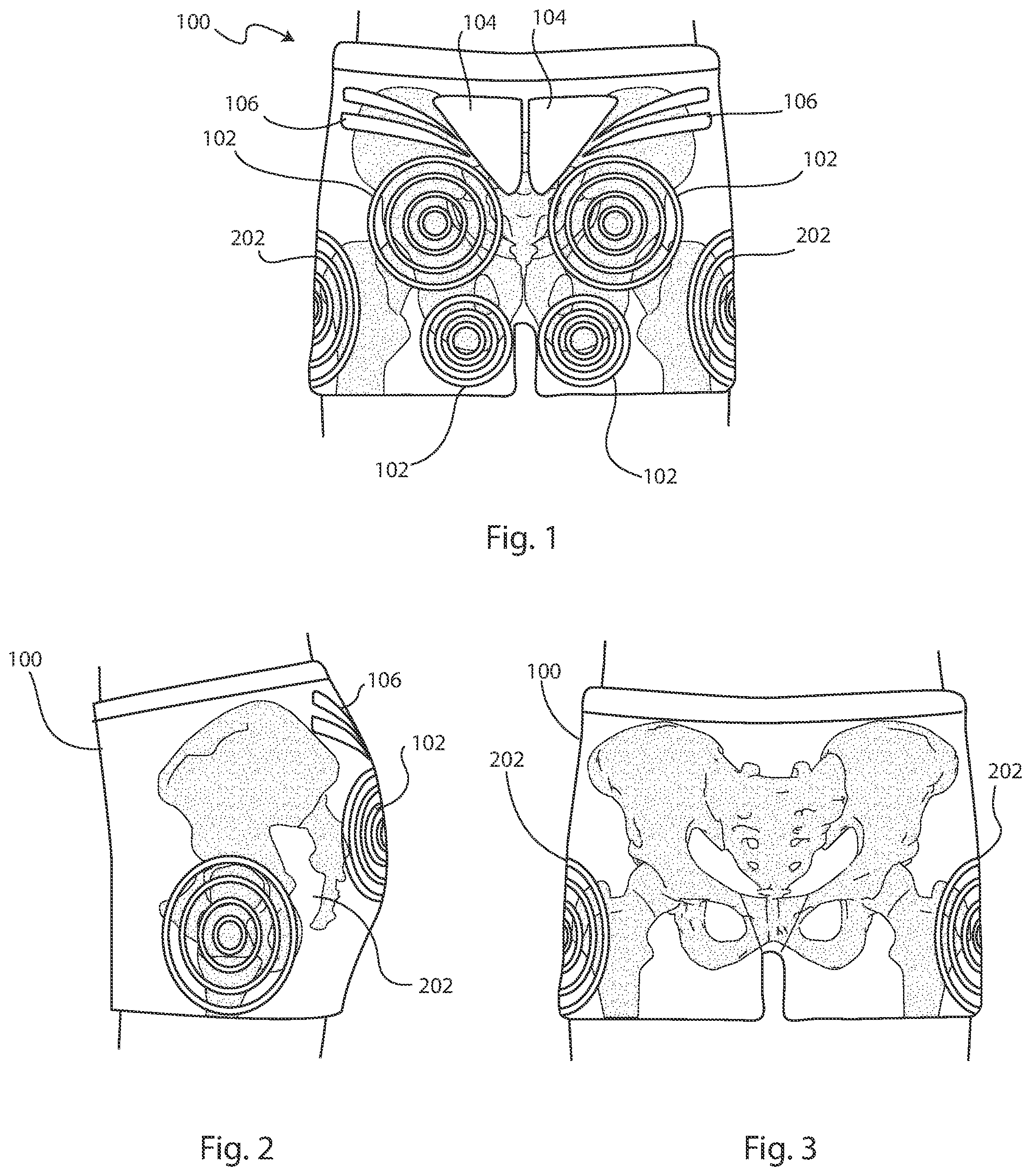 Patent US11812804 — Decubitus ulcers prevention garment — Figure 1