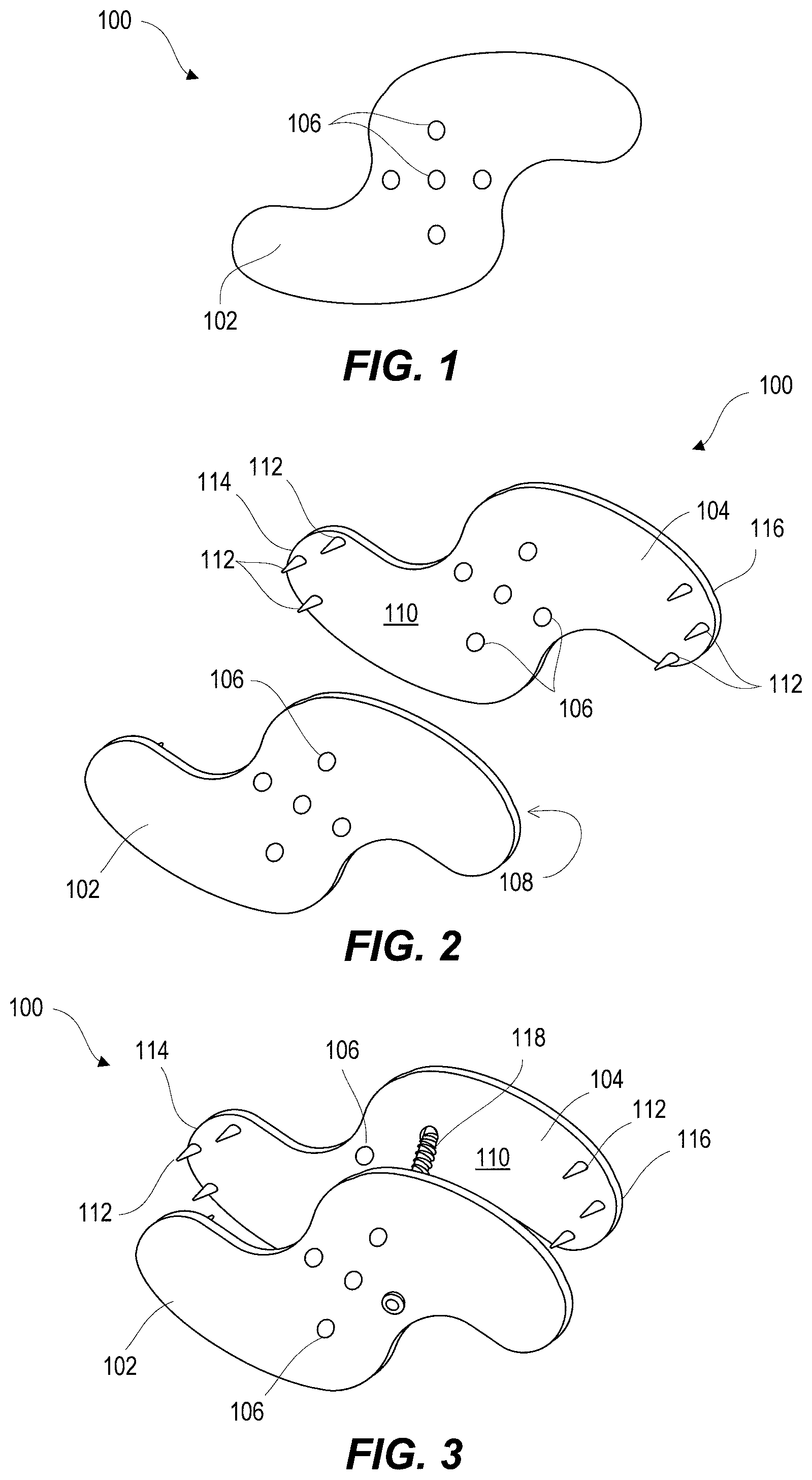 Patent US11812923 — Spinal fixation device — Figure 1