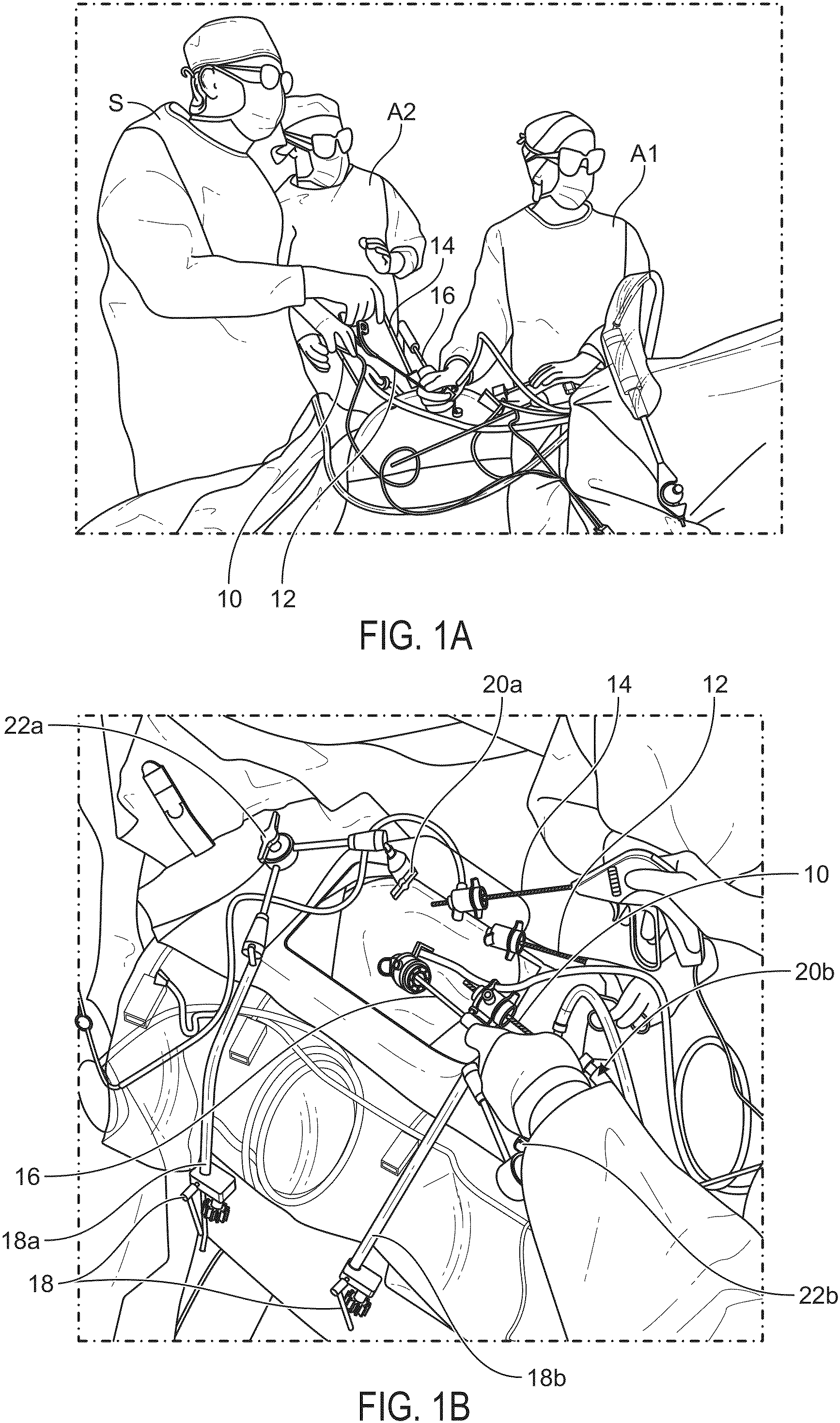 Patent US11812938 — Co-manipulation surgical system having a coupling mechanism removeably attachable to surgical instruments — Figure 1