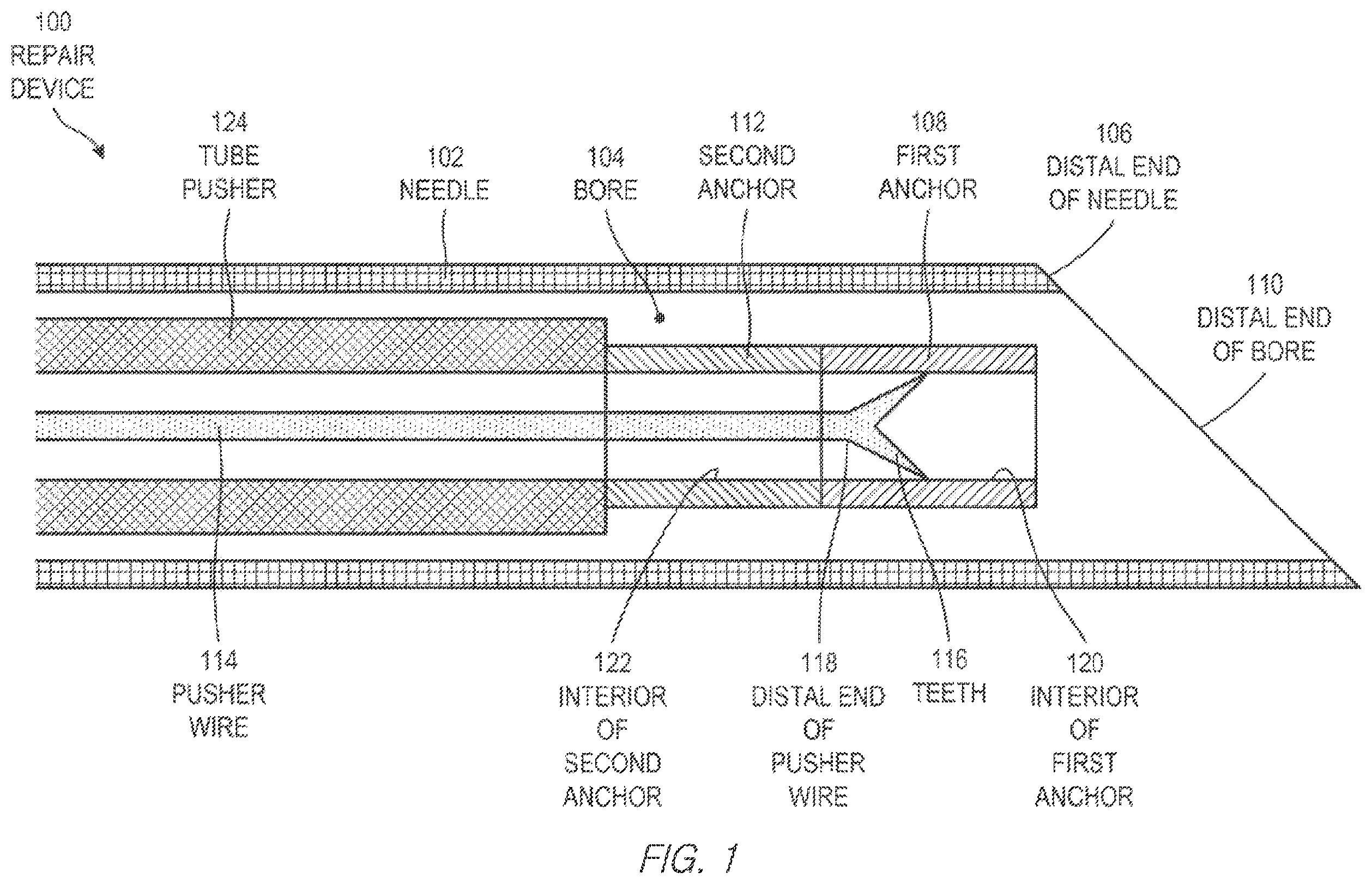 Patent US11812943 — Repair device and method for deploying anchors — Figure 1