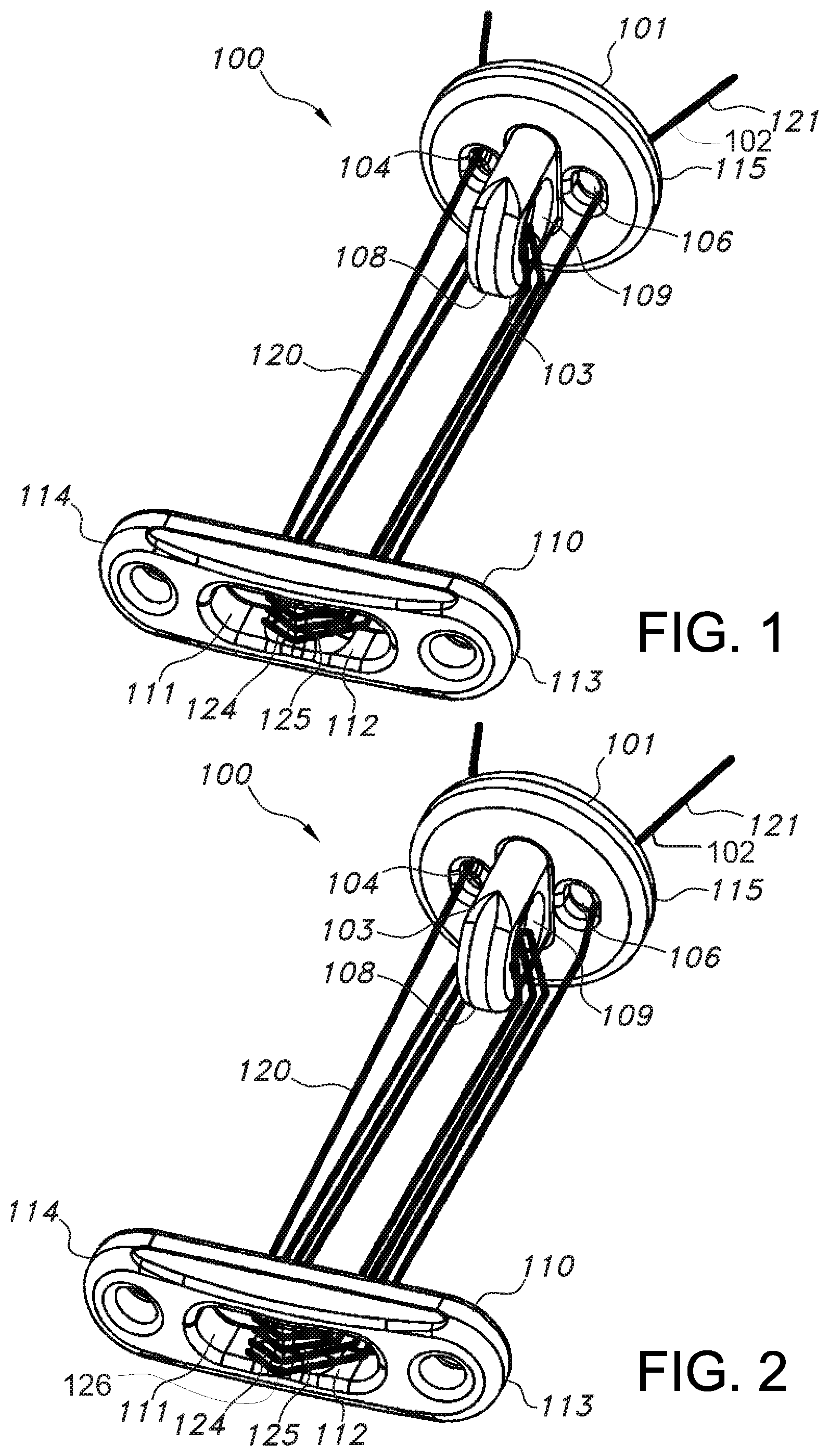 Patent US11812946 — Knotless orthopedic stabilization system — Figure 1