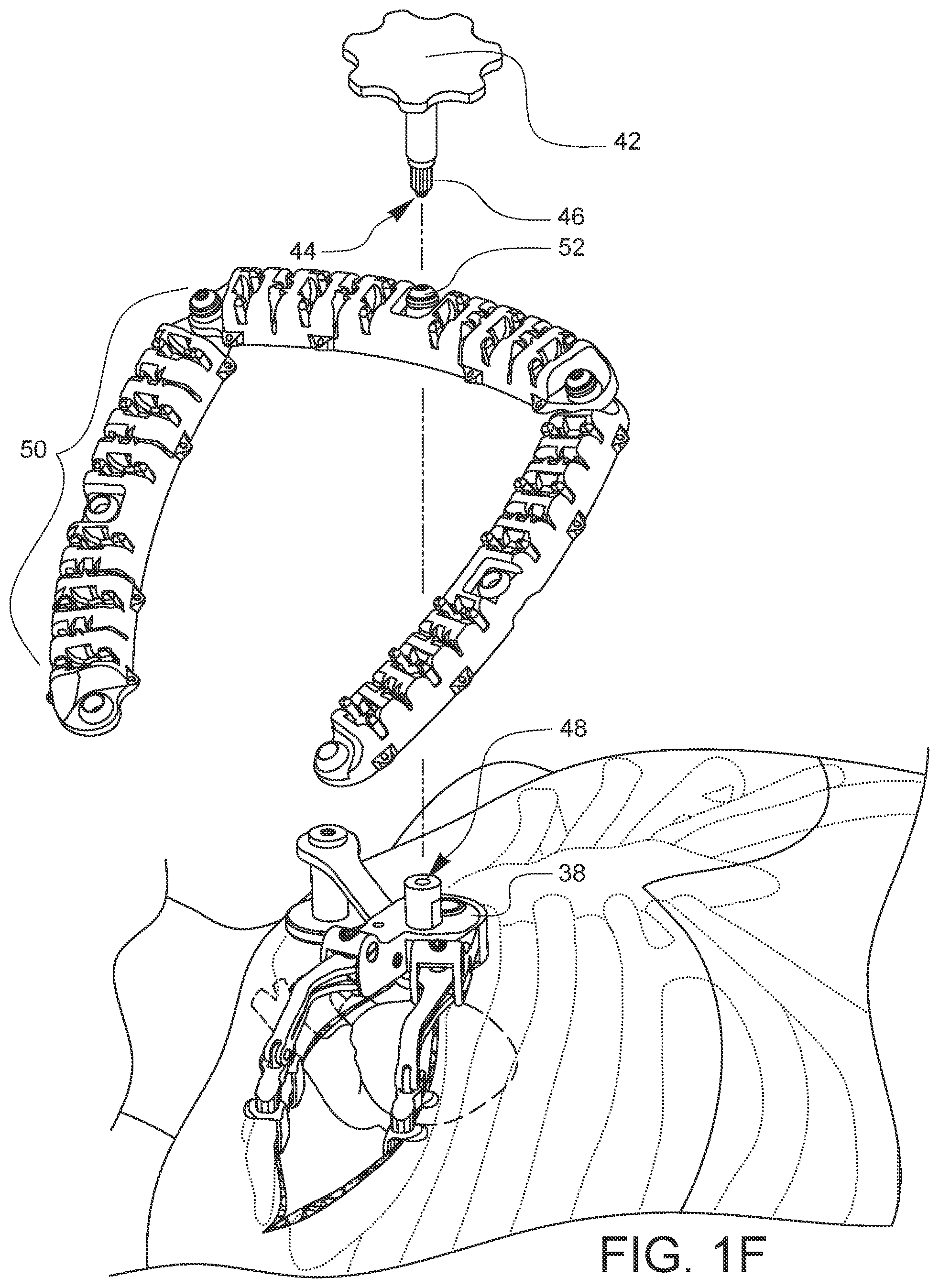 Patent US11812947 Figure 6 – Apparatus for suture management and methods thereof