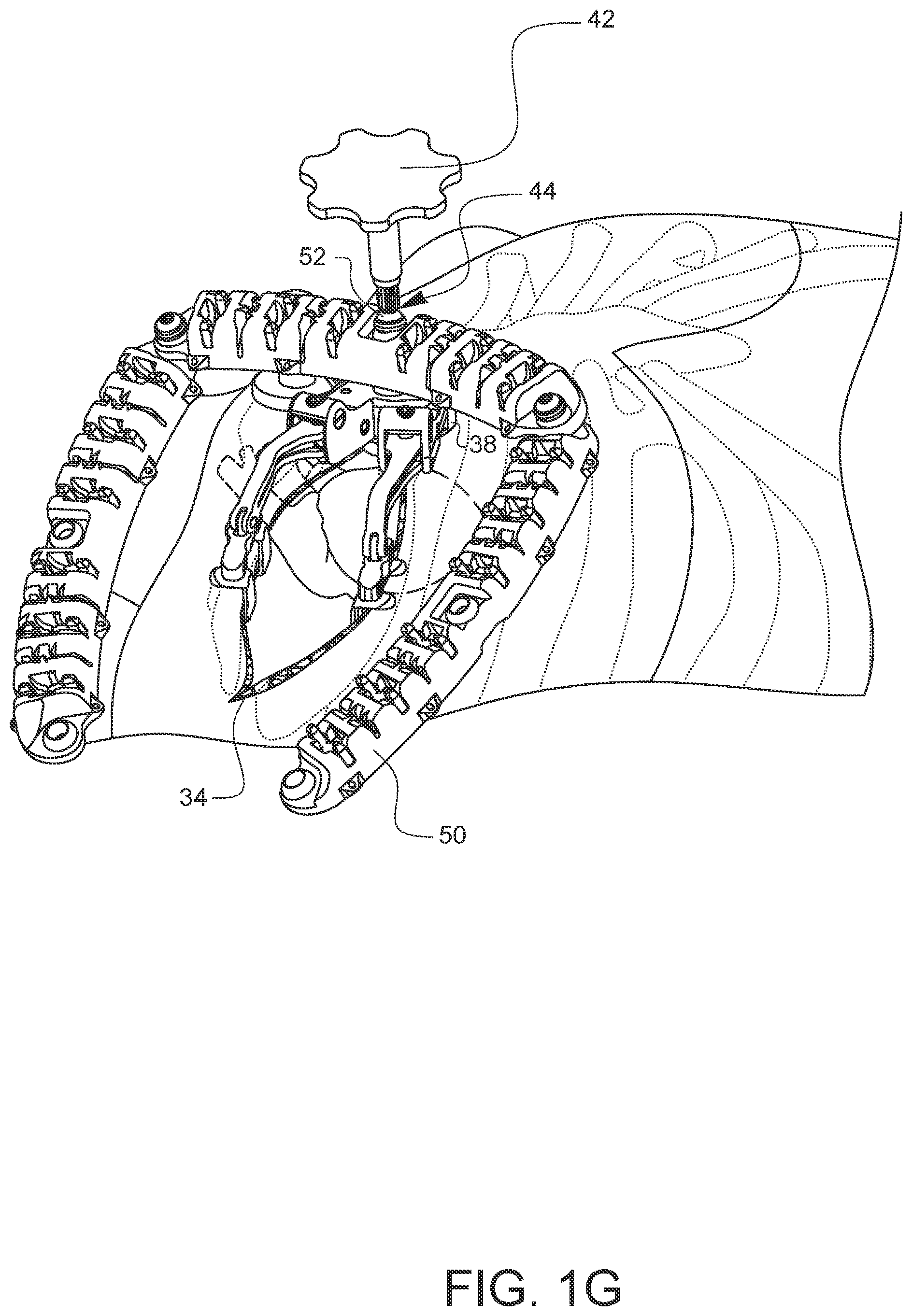 Patent US11812947 Figure 7 – Apparatus for suture management and methods thereof