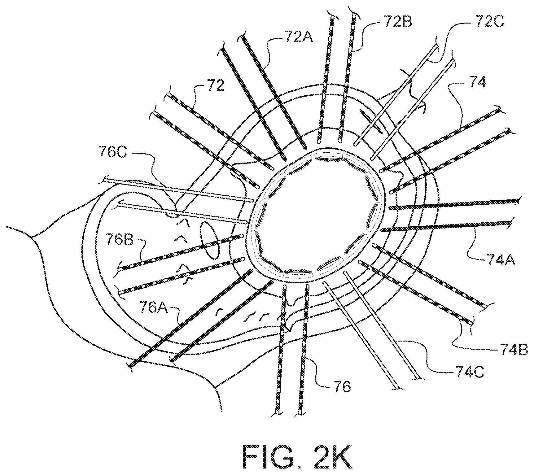 Patent US11812947 Figure 13 – Apparatus for suture management and methods thereof