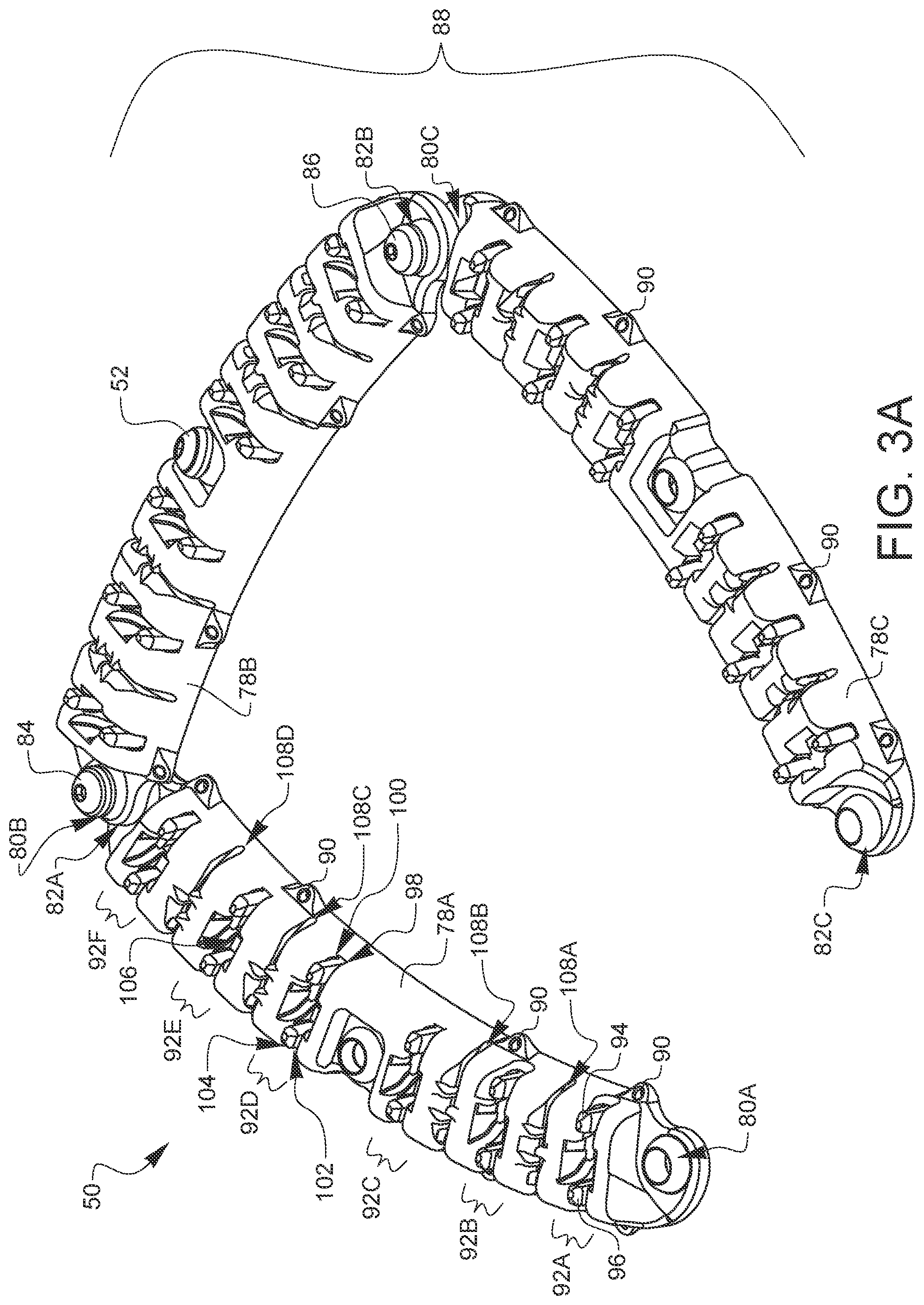 Patent US11812947 Figure 14 – Apparatus for suture management and methods thereof