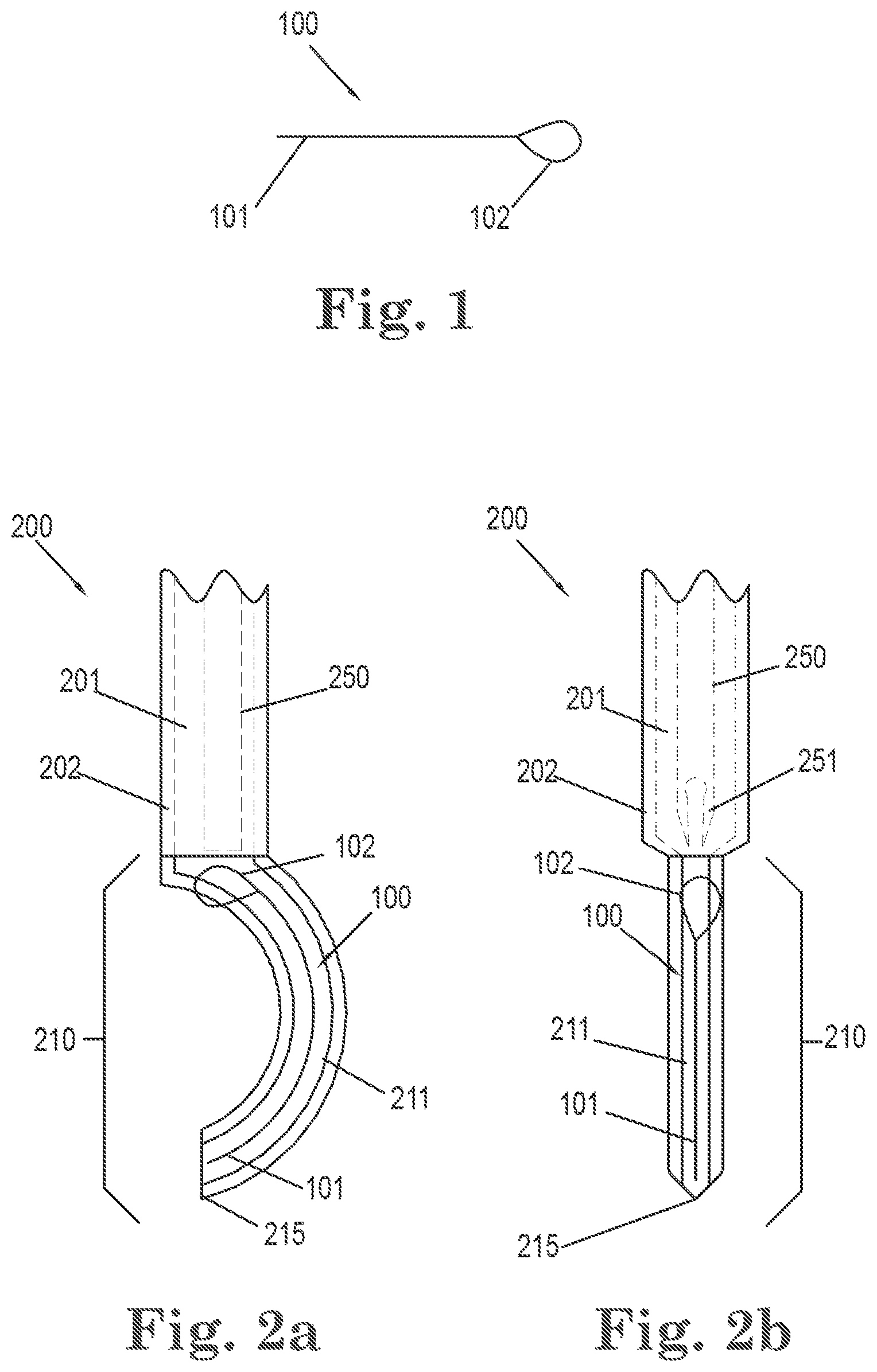 Patent US11812949 — Filamentous tissue implant — Figure 1