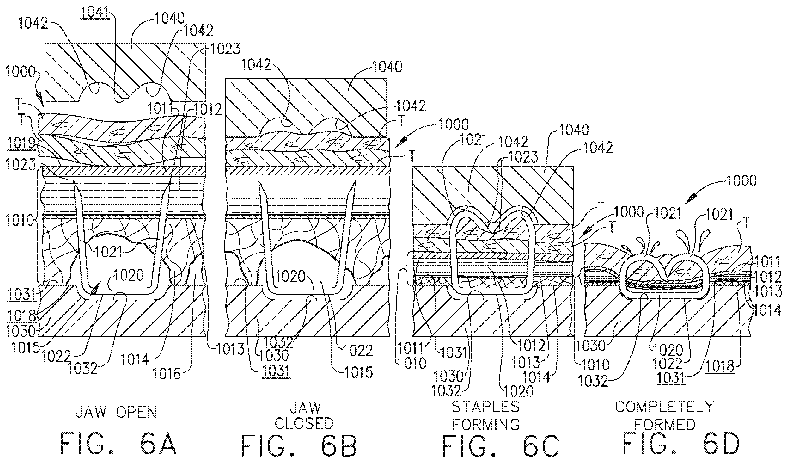 Patent US11812965 Figure 6 – Layer of material for a surgical end effector