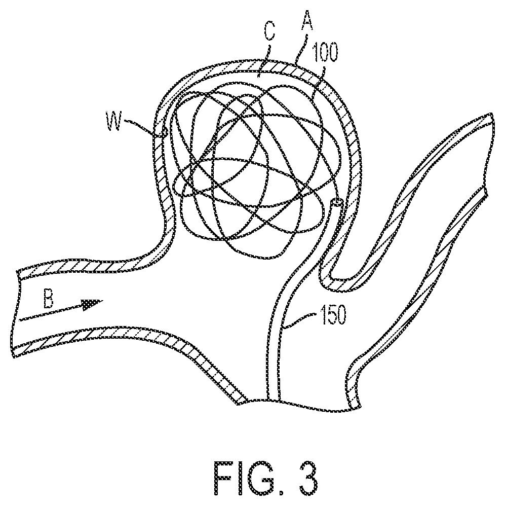 Patent US11812967 Figure 3 – Aneurysm treatment coils and associated systems and methods of use