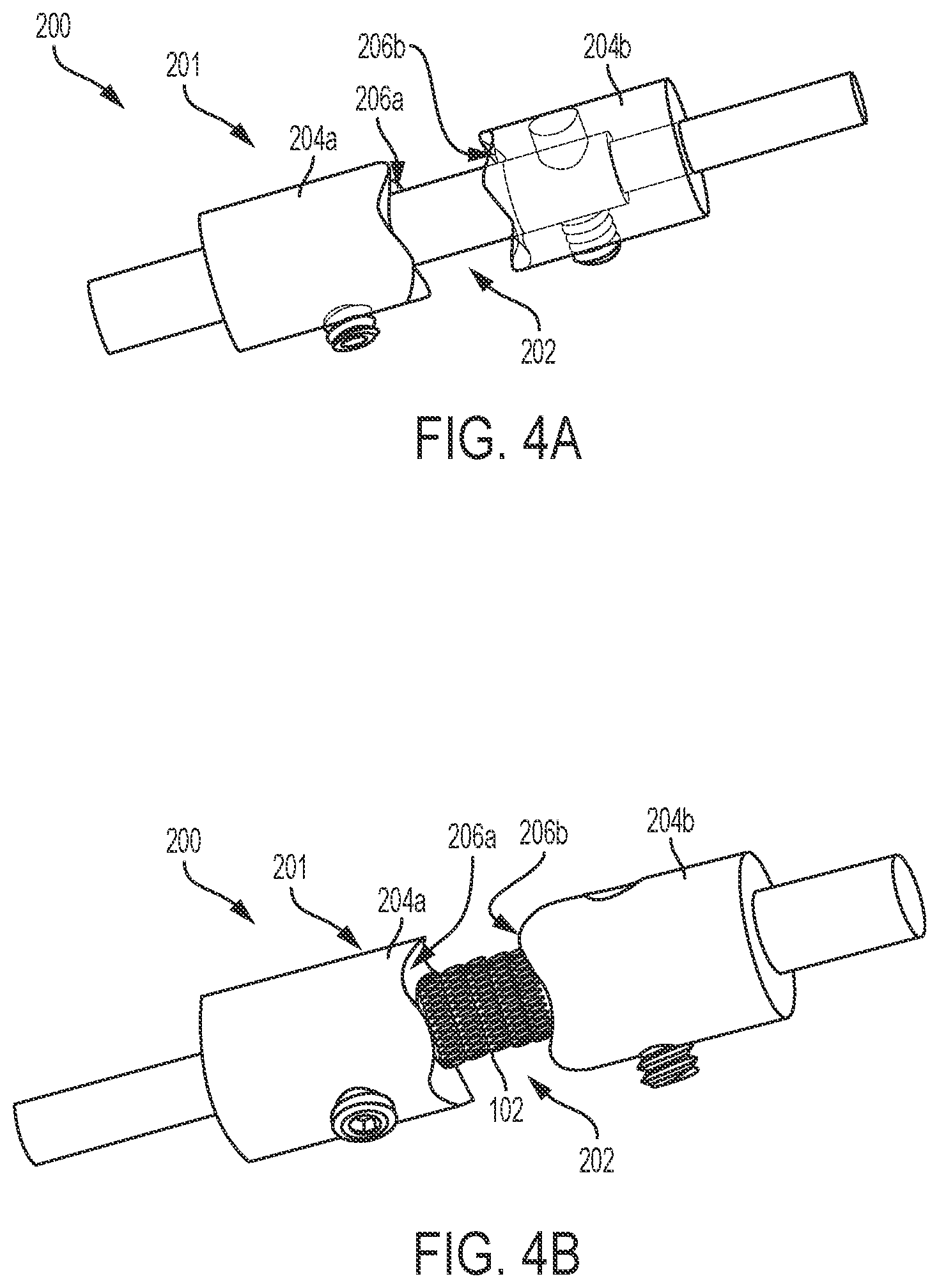 Patent US11812967 Figure 4 – Aneurysm treatment coils and associated systems and methods of use