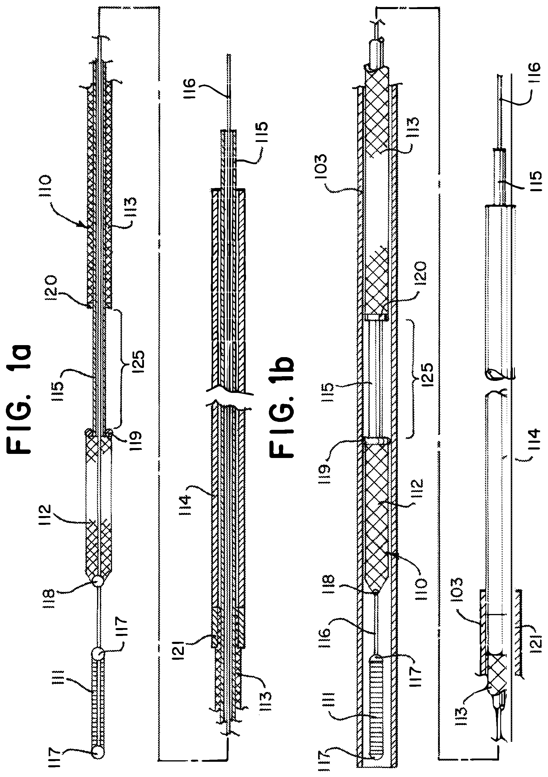 Patent US11812981 — Vasculature obstruction capture device — Figure 1