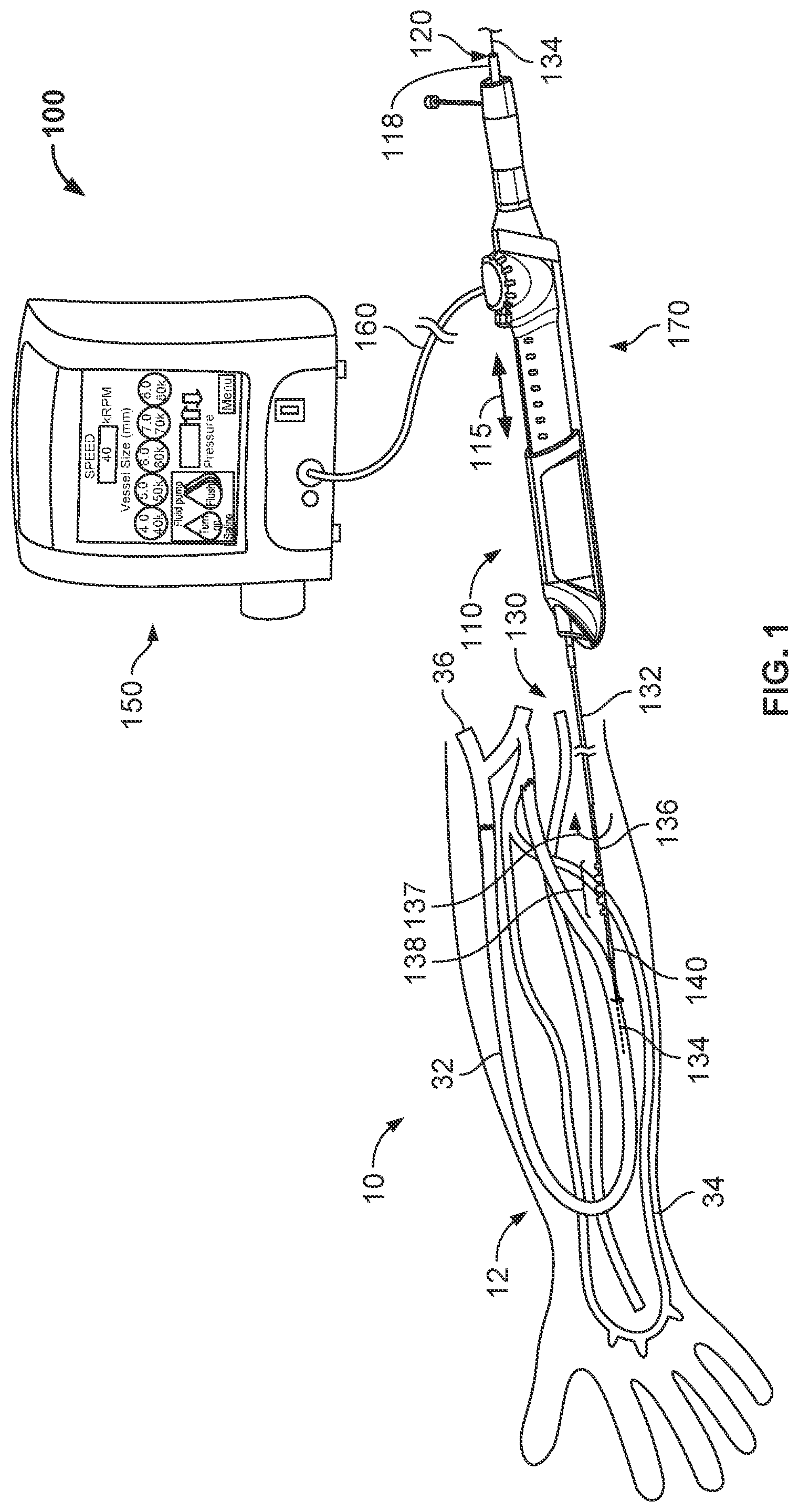 Patent US11812988 — Atherectomy devices and methods — Figure 1