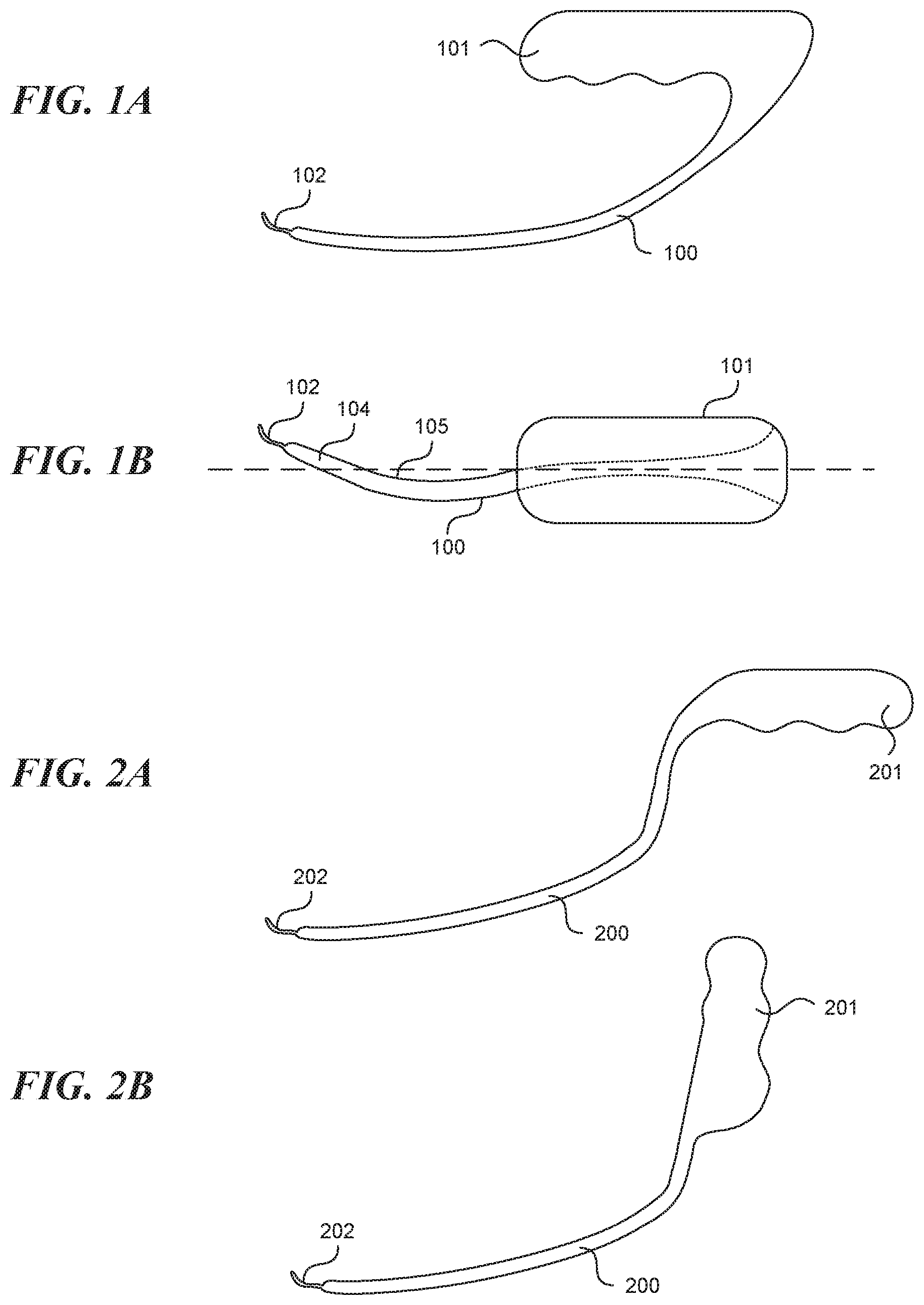 Patent US11812990 — Systems and methods for endoluminal valve creation — Figure 1
