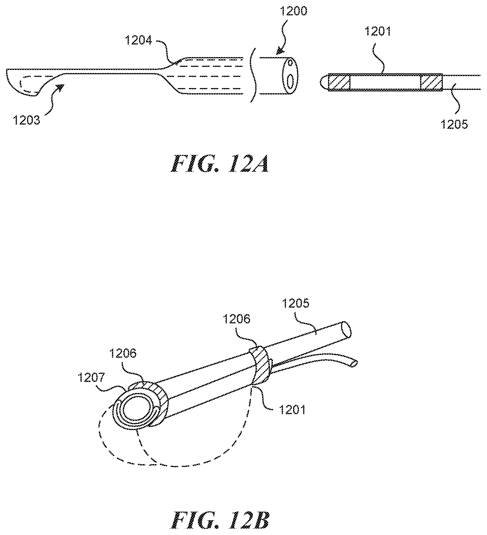Patent US11812990 Figure 10 – Systems and methods for endoluminal valve creation