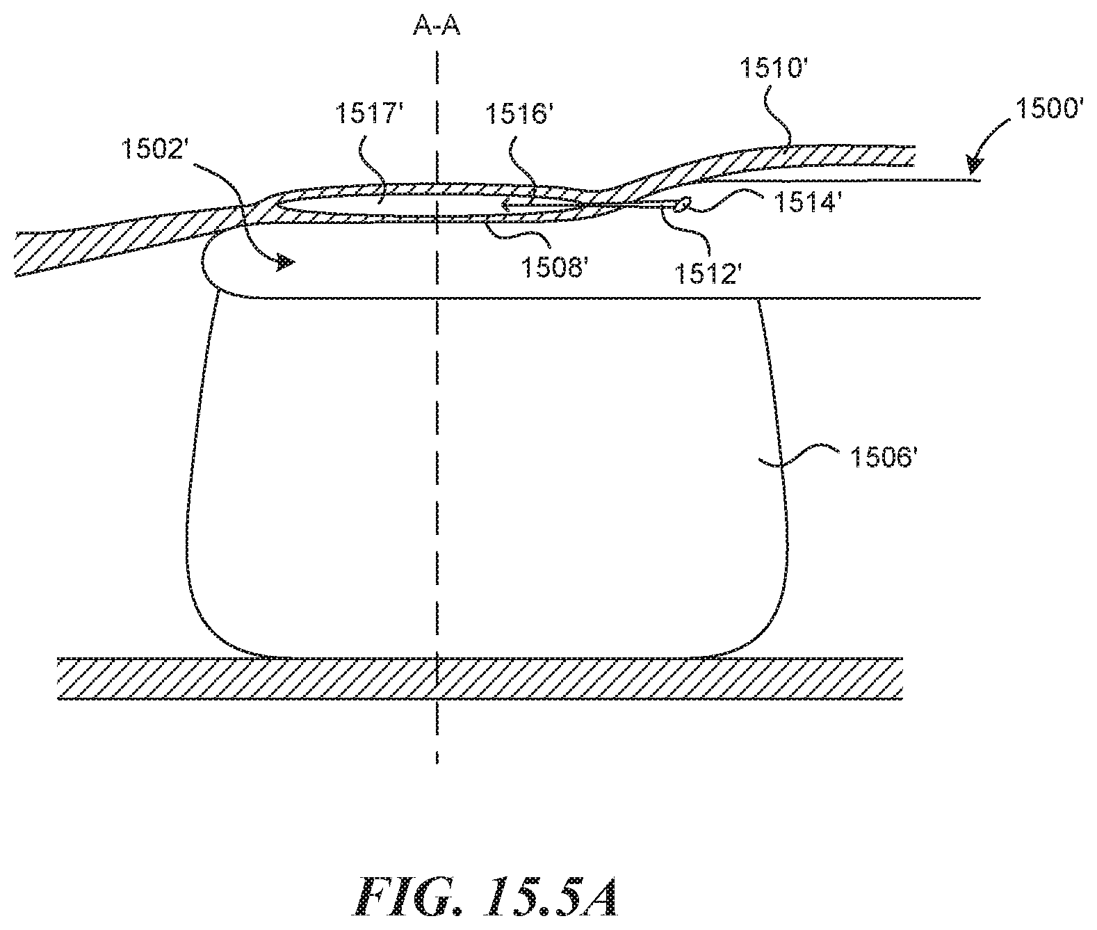 Patent US11812990 Figure 14 – Systems and methods for endoluminal valve creation