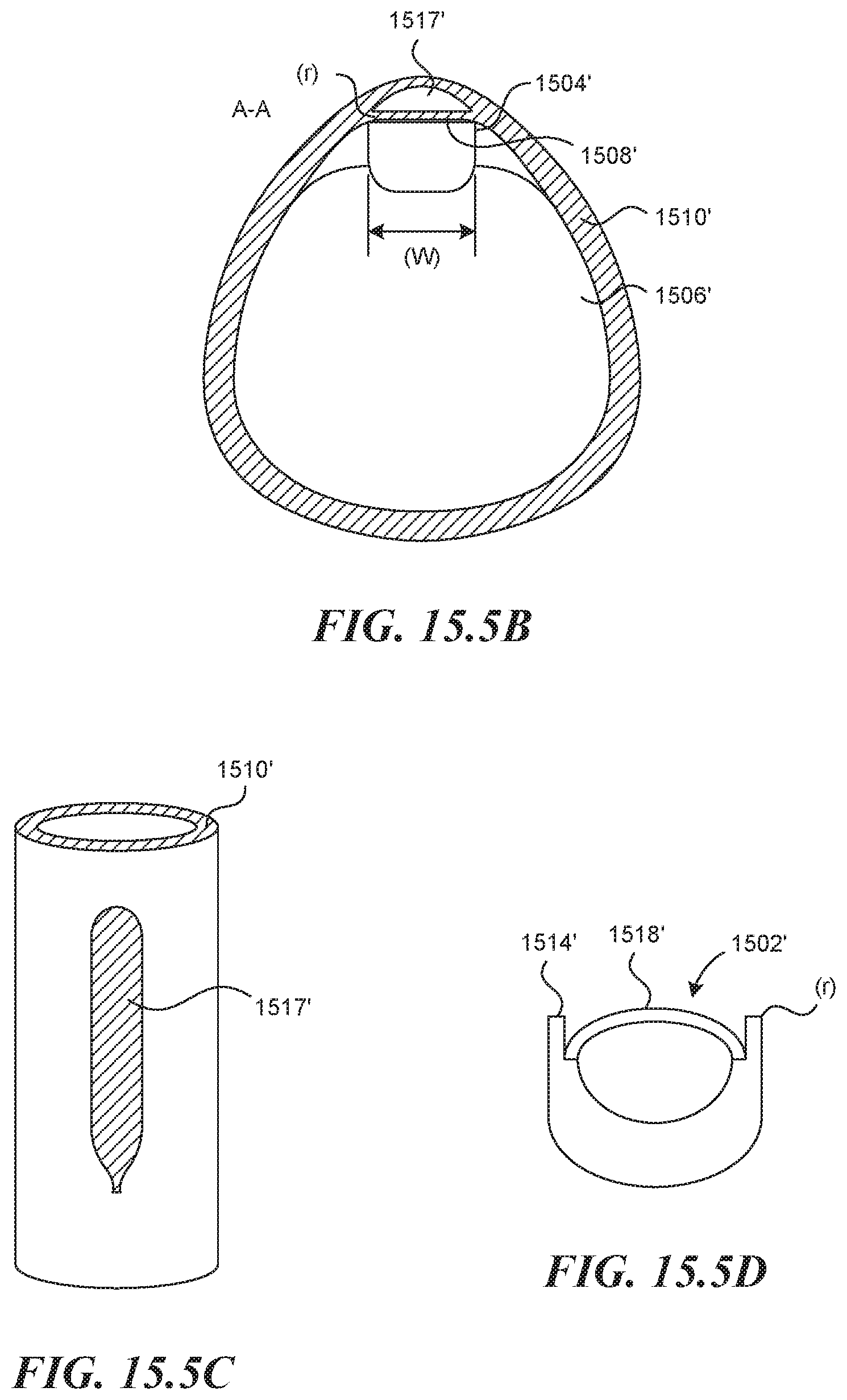 Patent US11812990 Figure 15 – Systems and methods for endoluminal valve creation