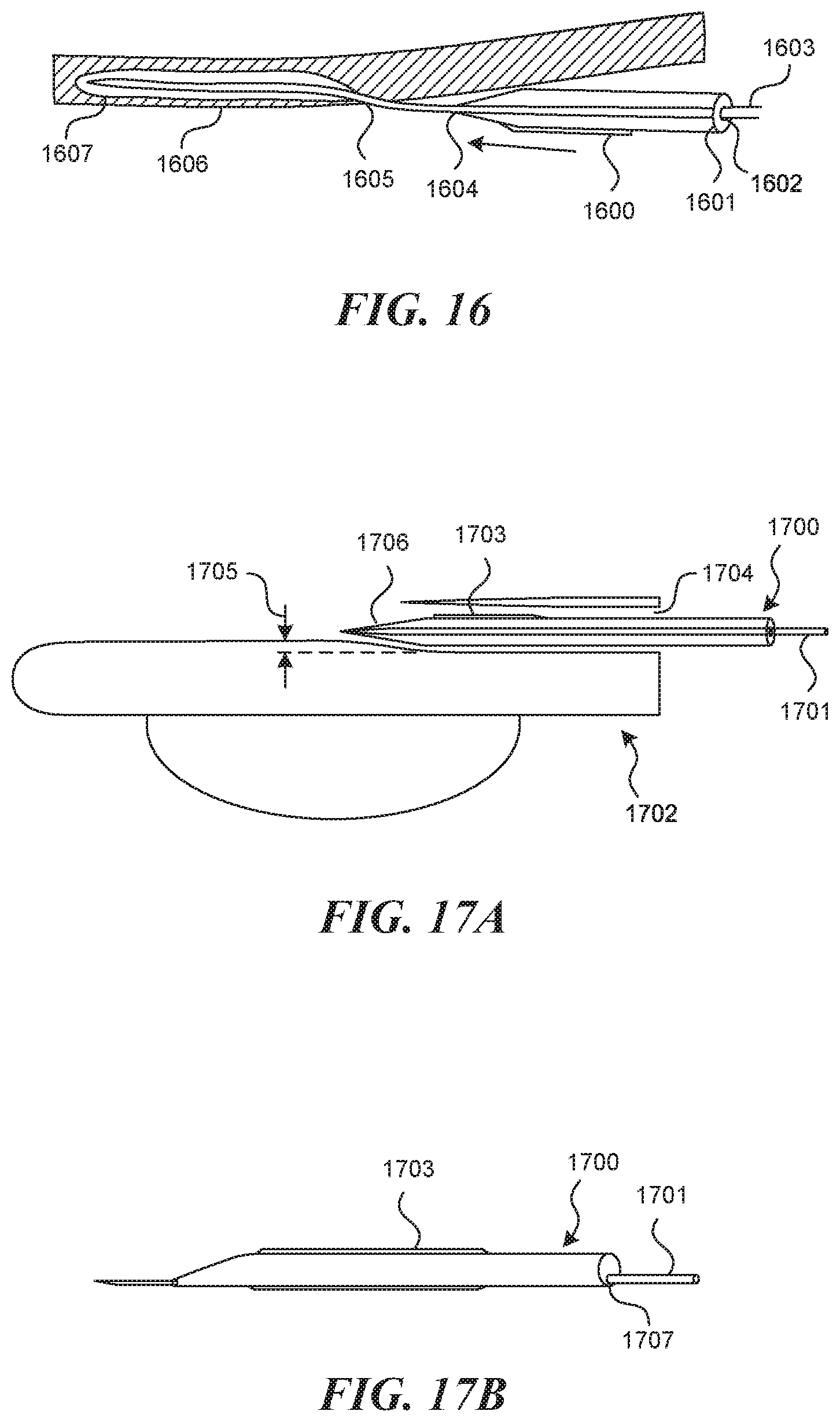 Patent US11812990 Figure 16 – Systems and methods for endoluminal valve creation
