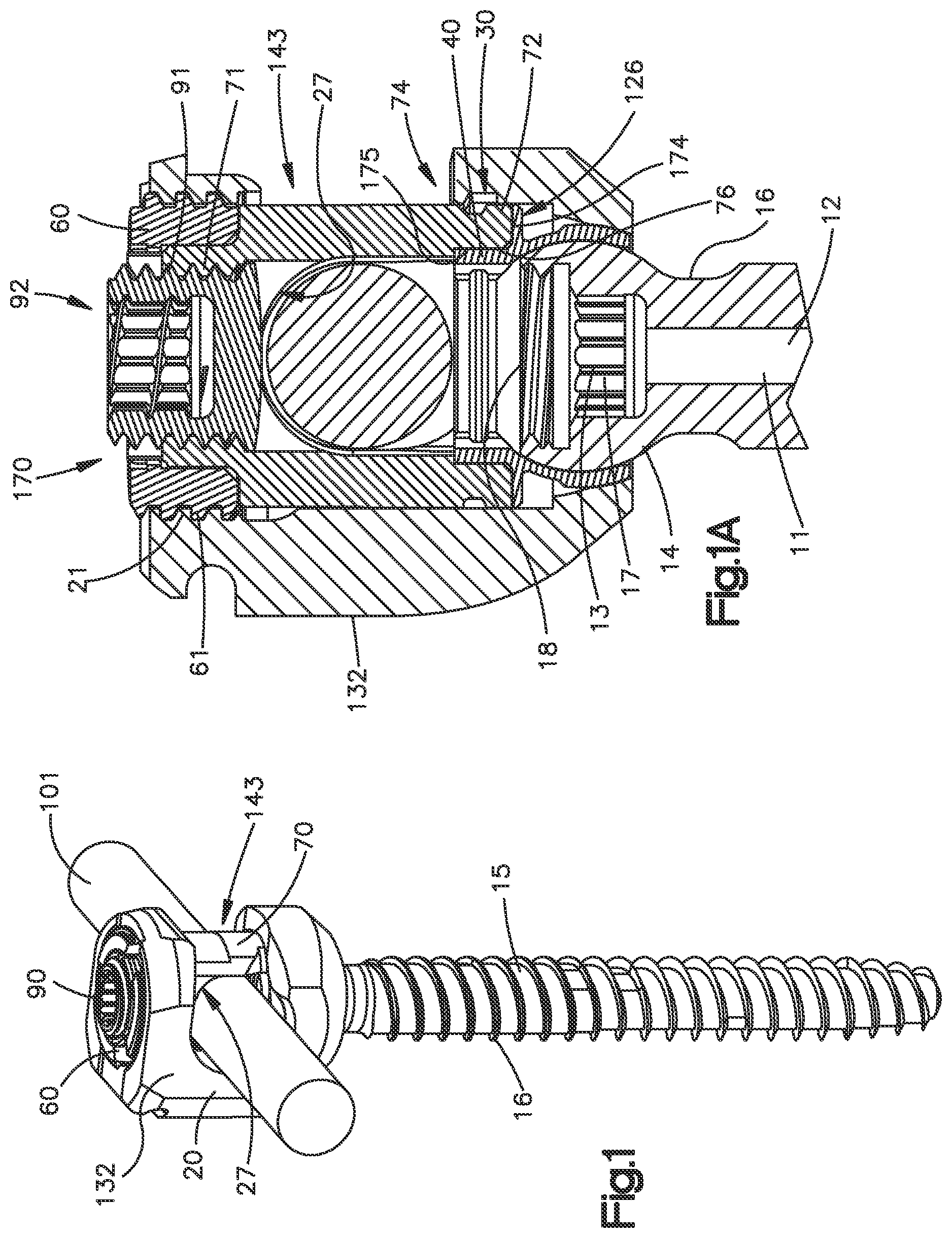 Patent US11812998 — Bone fixation assembly — Figure 1
