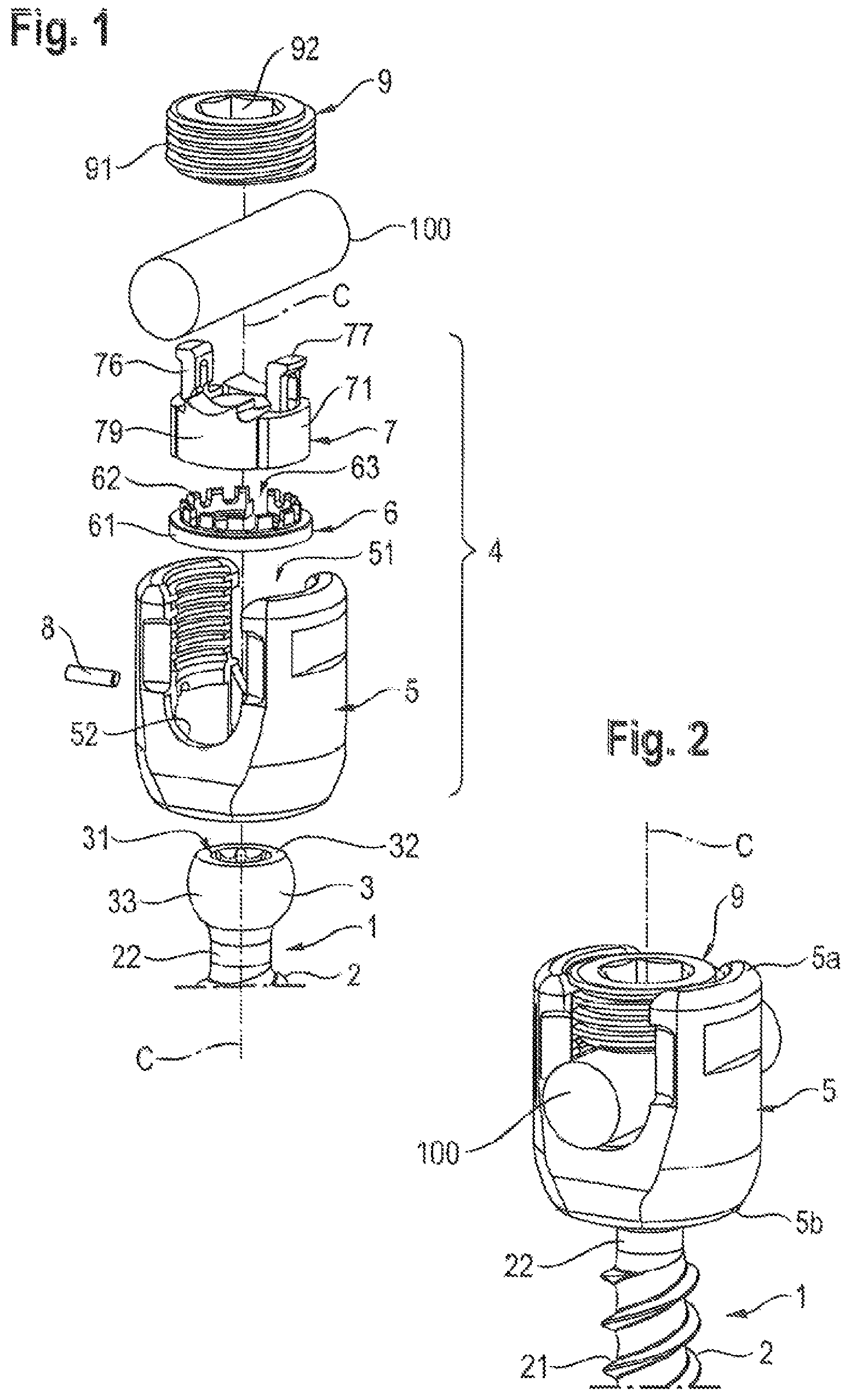 Patent US11812999 — Coupling assembly and polyaxial bone anchoring device comprising the same — Figure 1