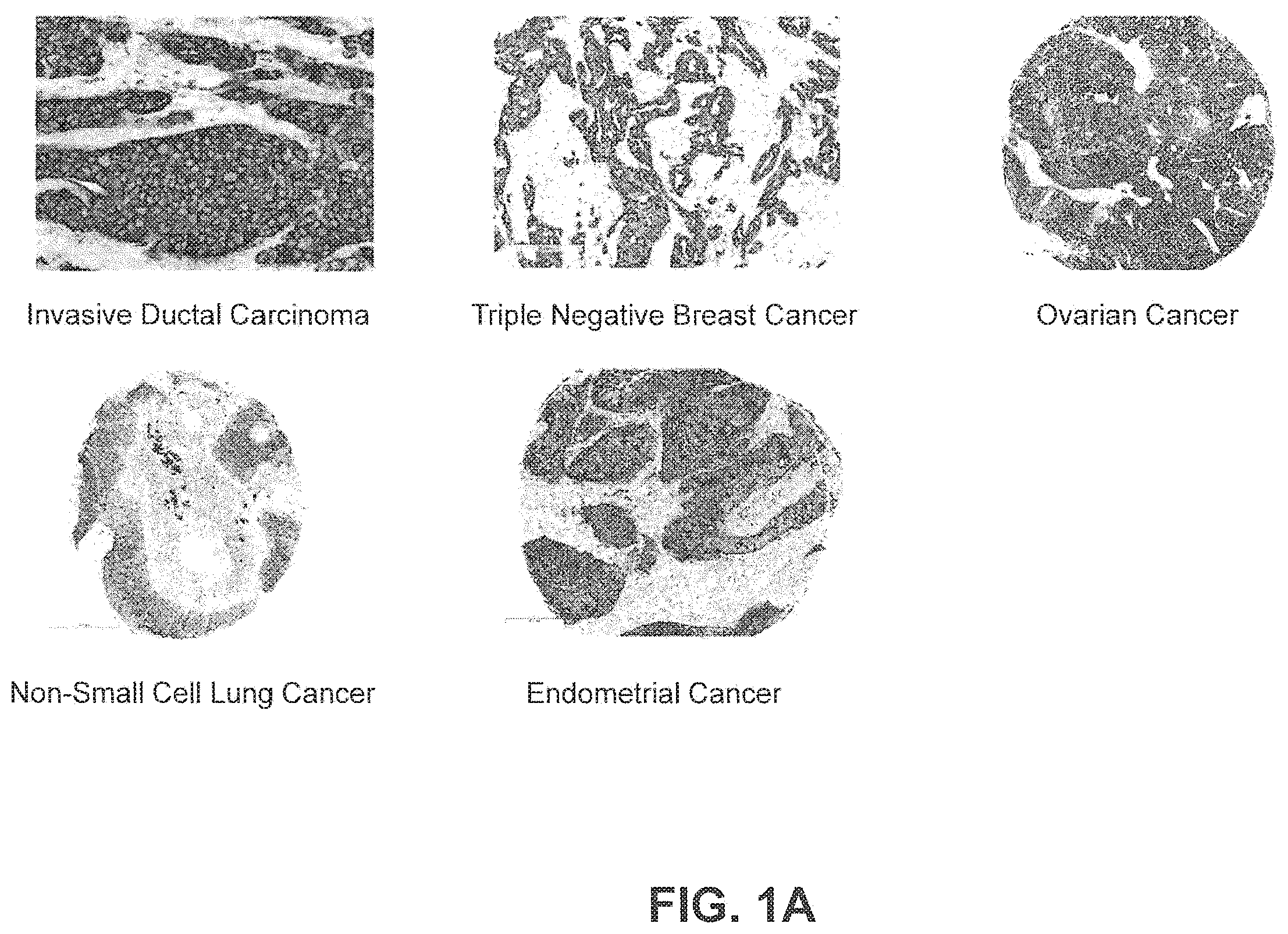 Patent US11814431 — B7-H4 antibodies and methods of use thereof — Figure 1