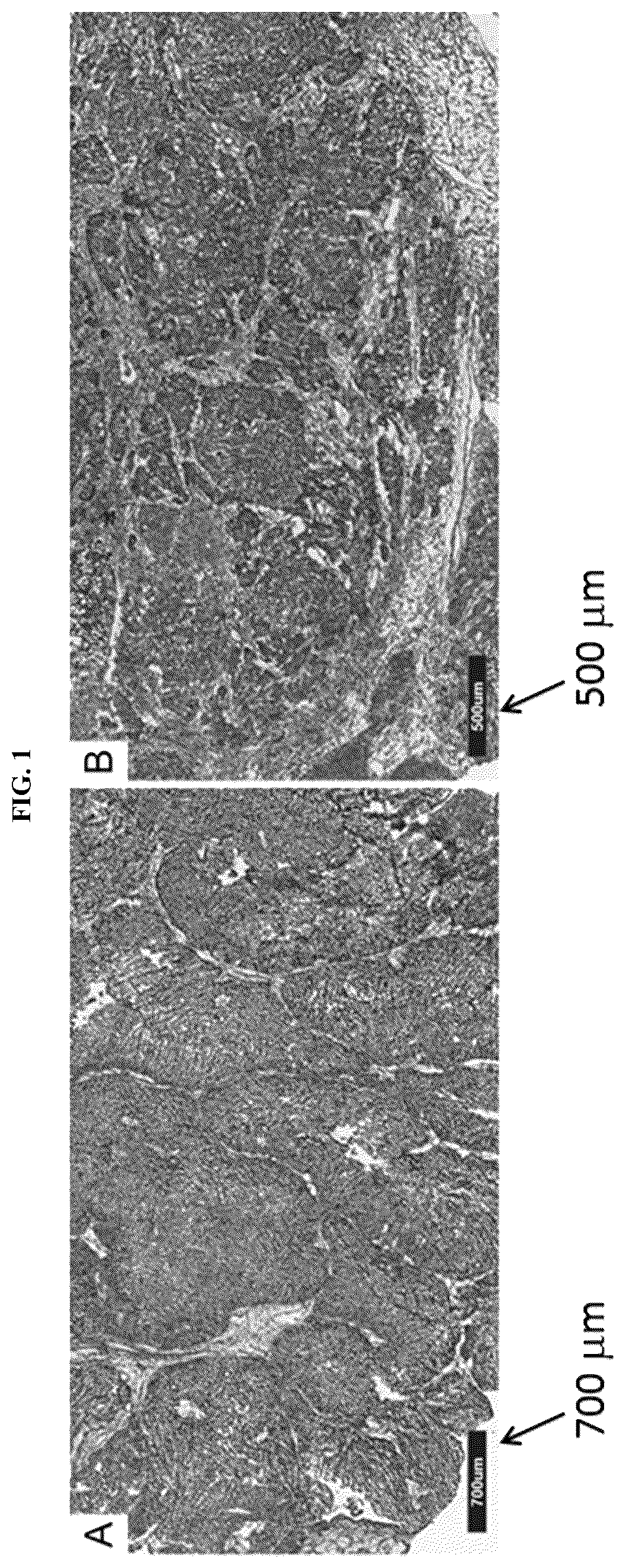 Patent US11814687 — Methods for characterizing bladder cancer — Figure 1