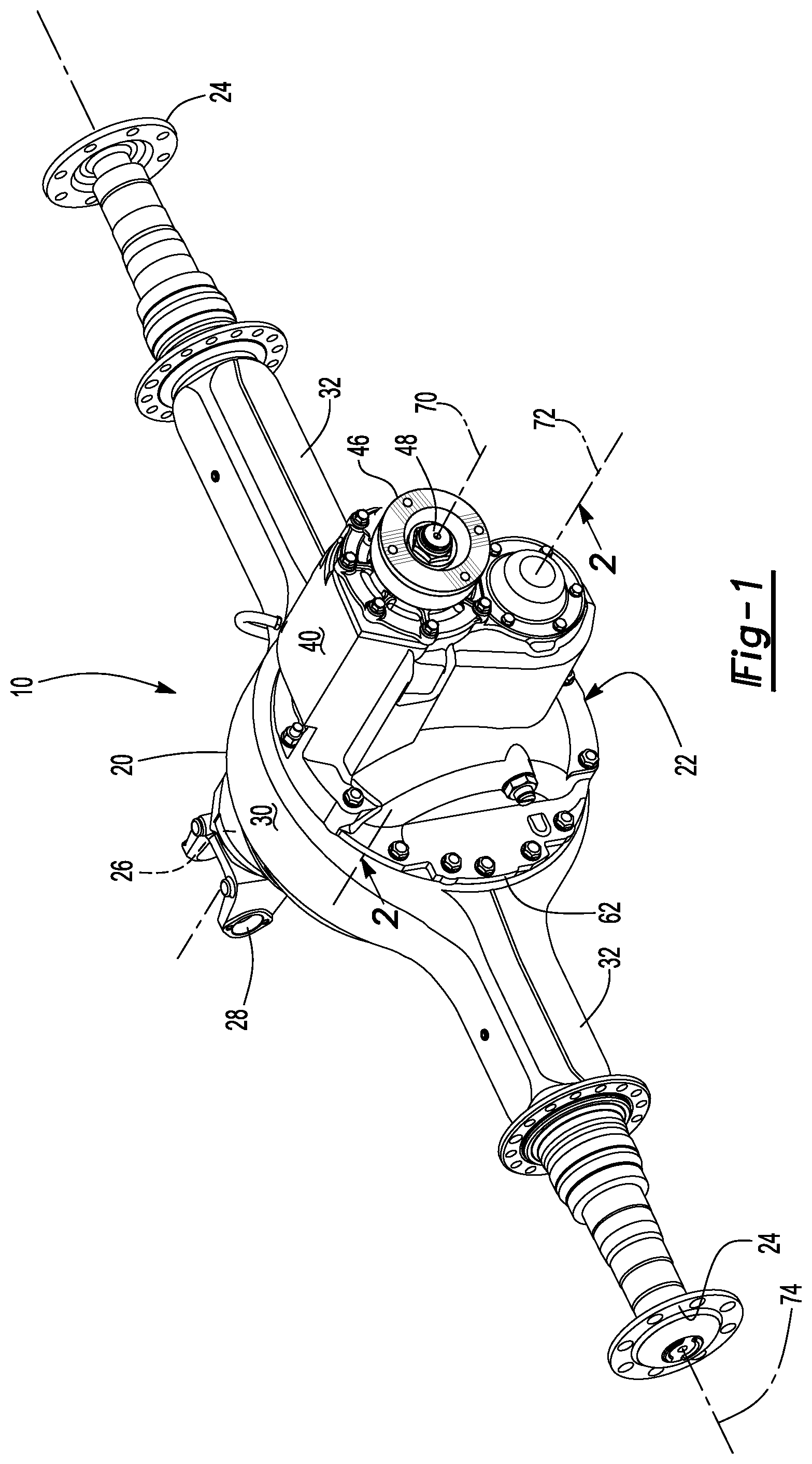 Patent US11815174 — Differential carrier assembly — Figure 1