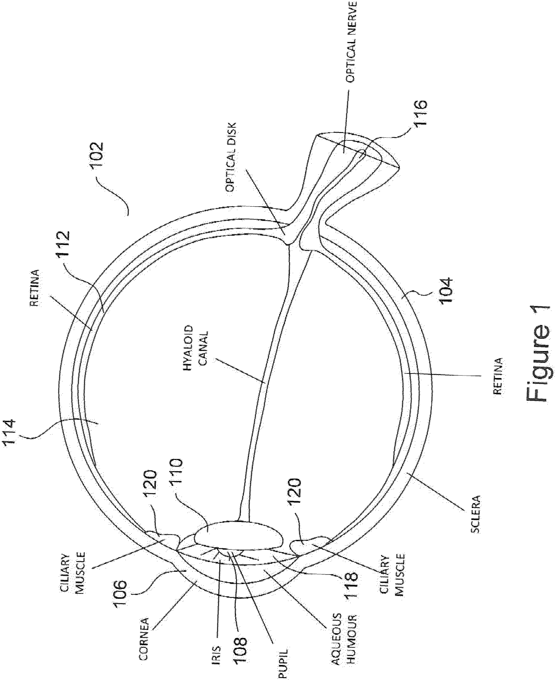 Patent US11815745 — Method and apparatus for limiting growth of eye length — Figure 1