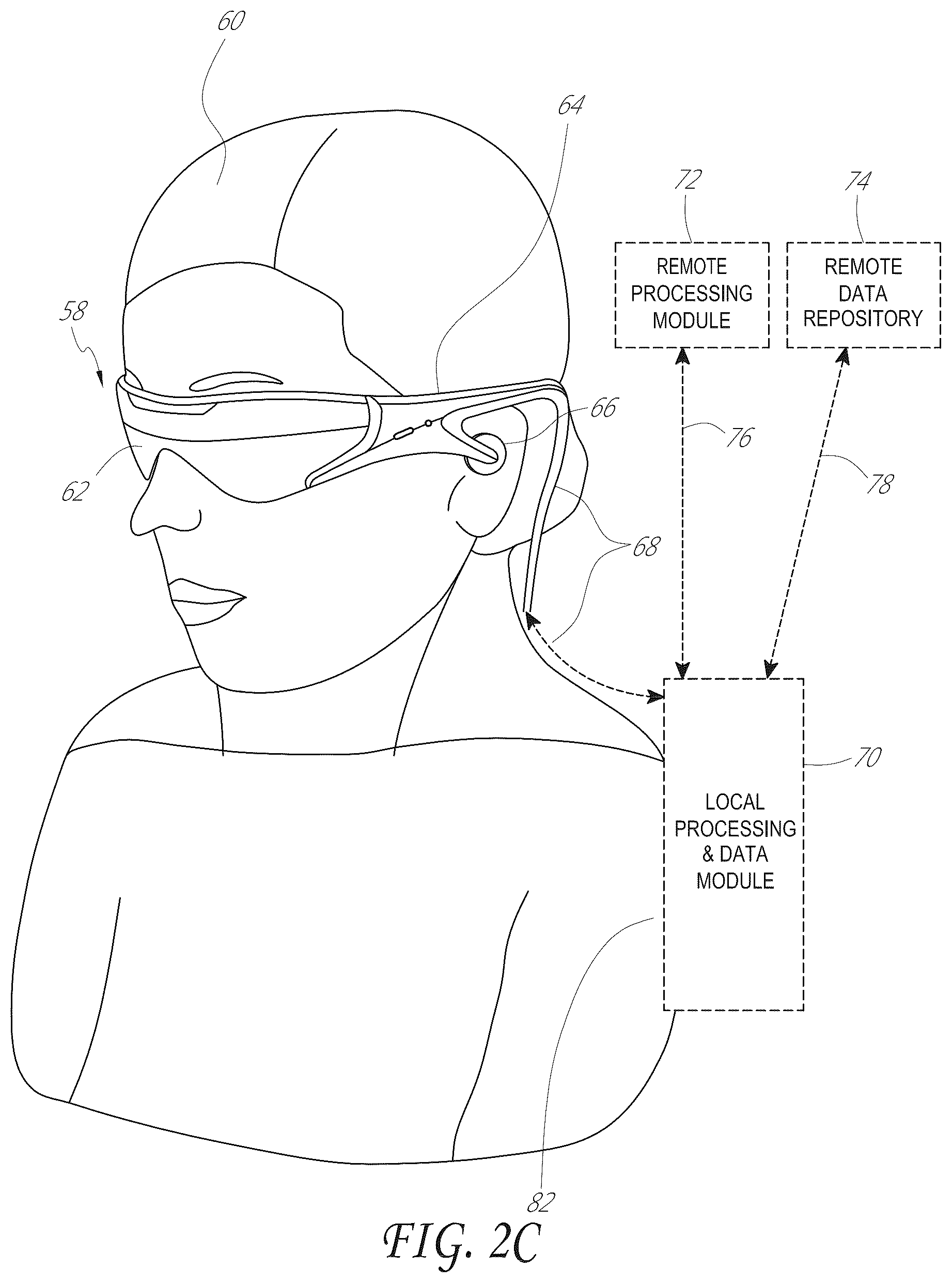 Patent US11836284 Figure 4 – Sensor fusion for electromagnetic tracking