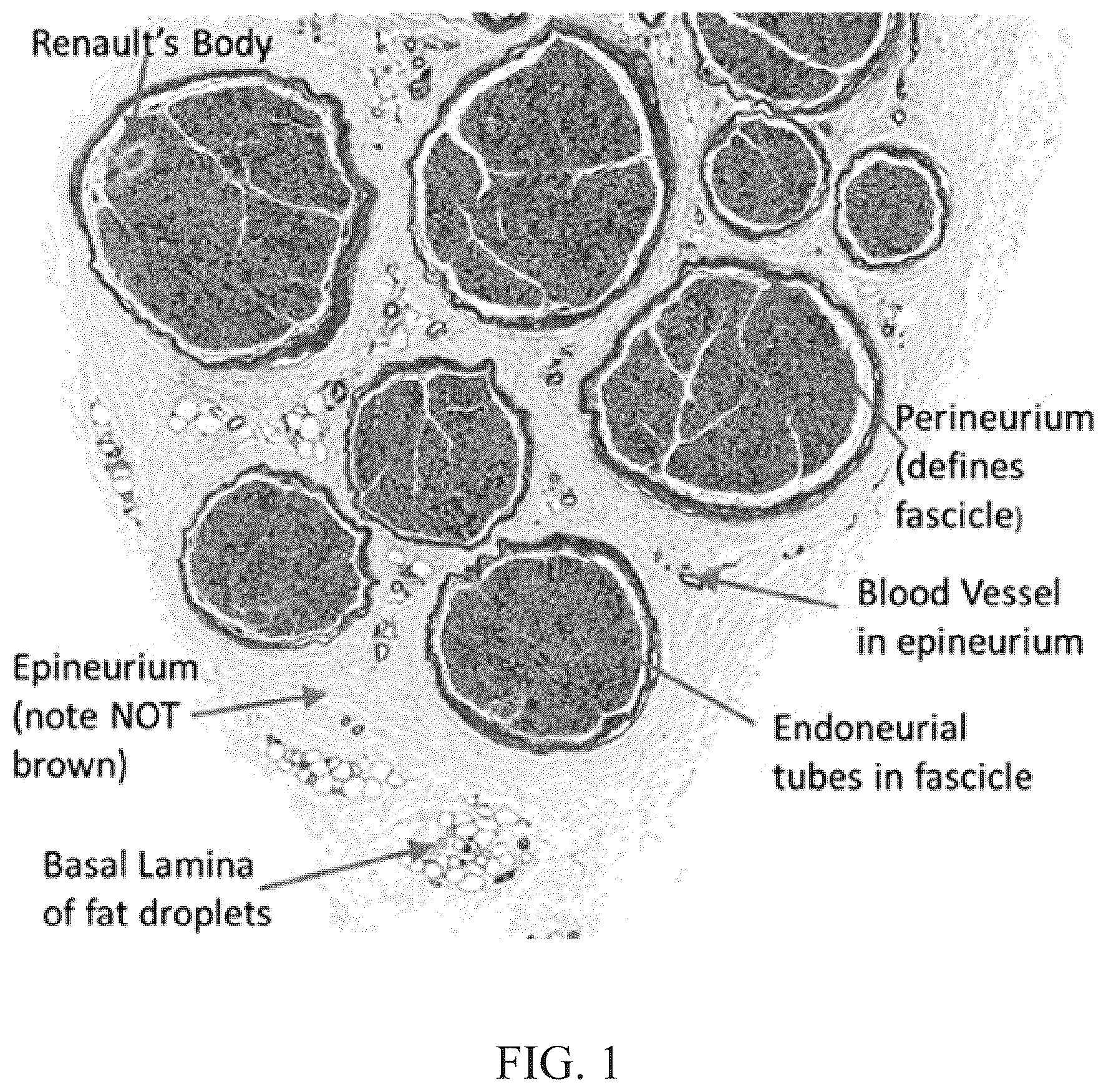 Patent US11847844 — Quantitative structural assay of a nerve graft — Figure 1