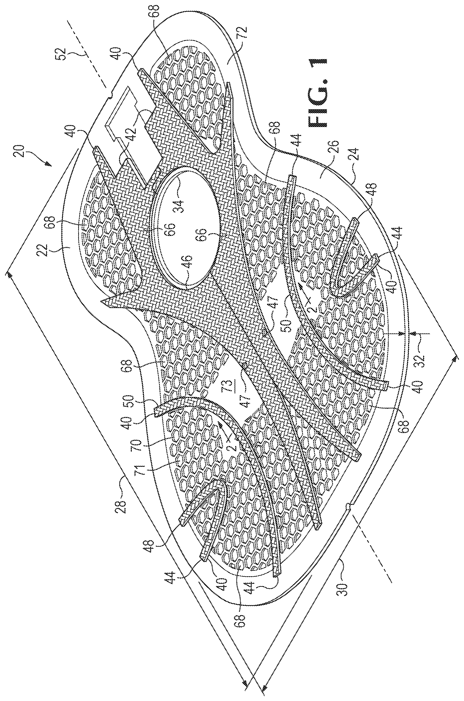 Patent US11854517 — Soundboards and backboards for acoustic stringed instruments — Figure 1