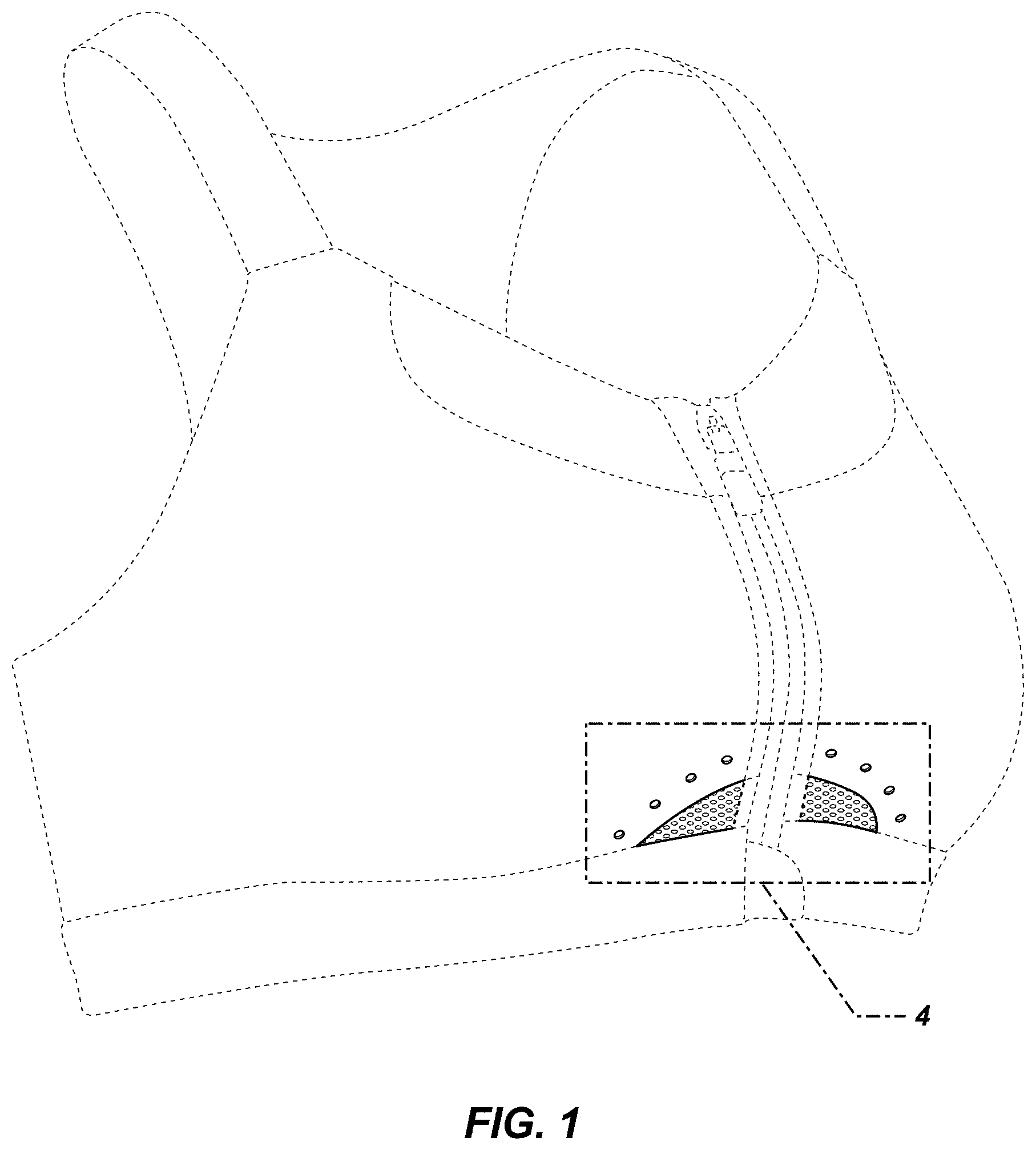 Patent USD0999491 — Bra — Figure 1