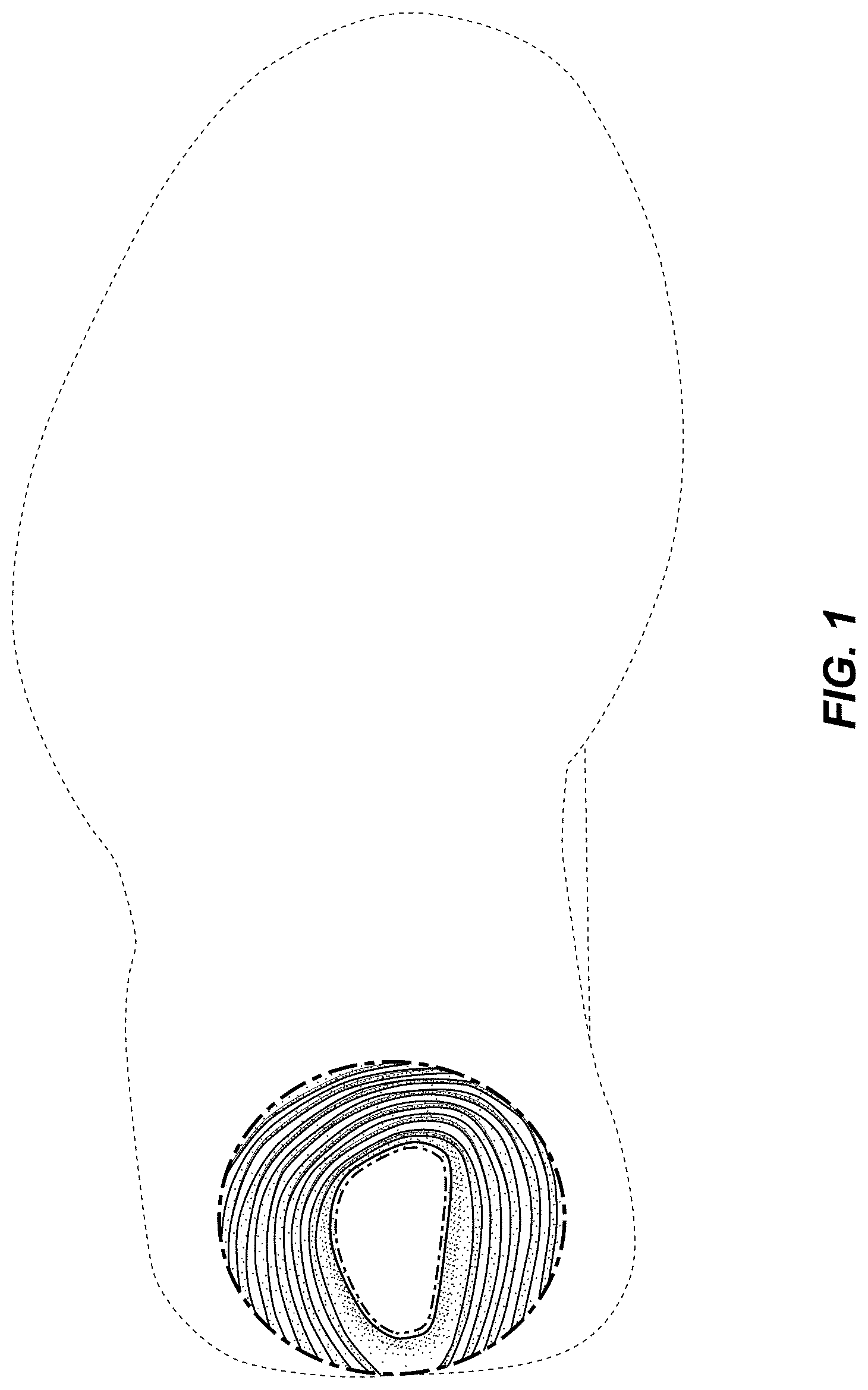 Patent USD0999500 — Shoe — Figure 1