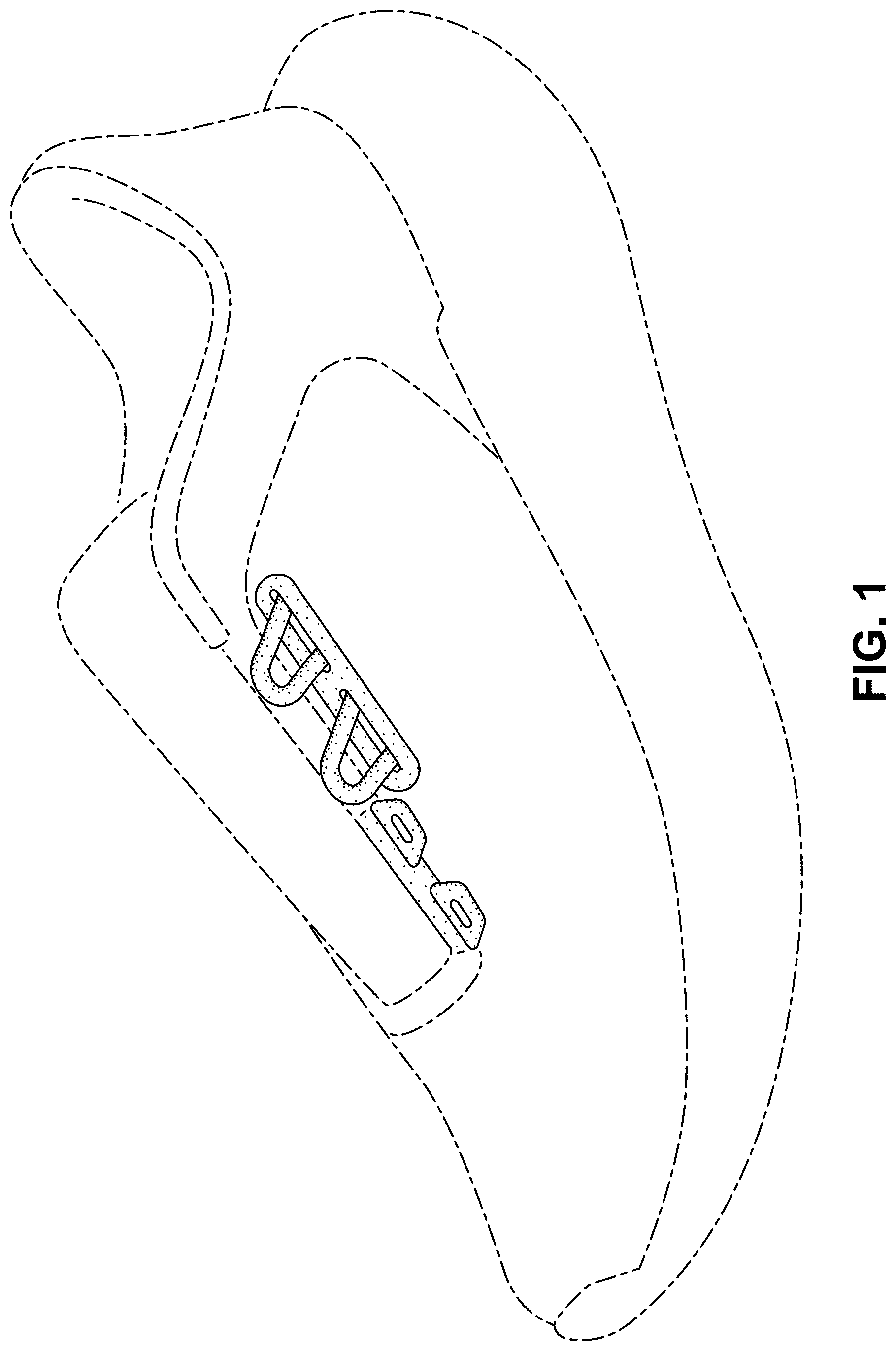 Patent USD0999512 Figure 1 – Shoe