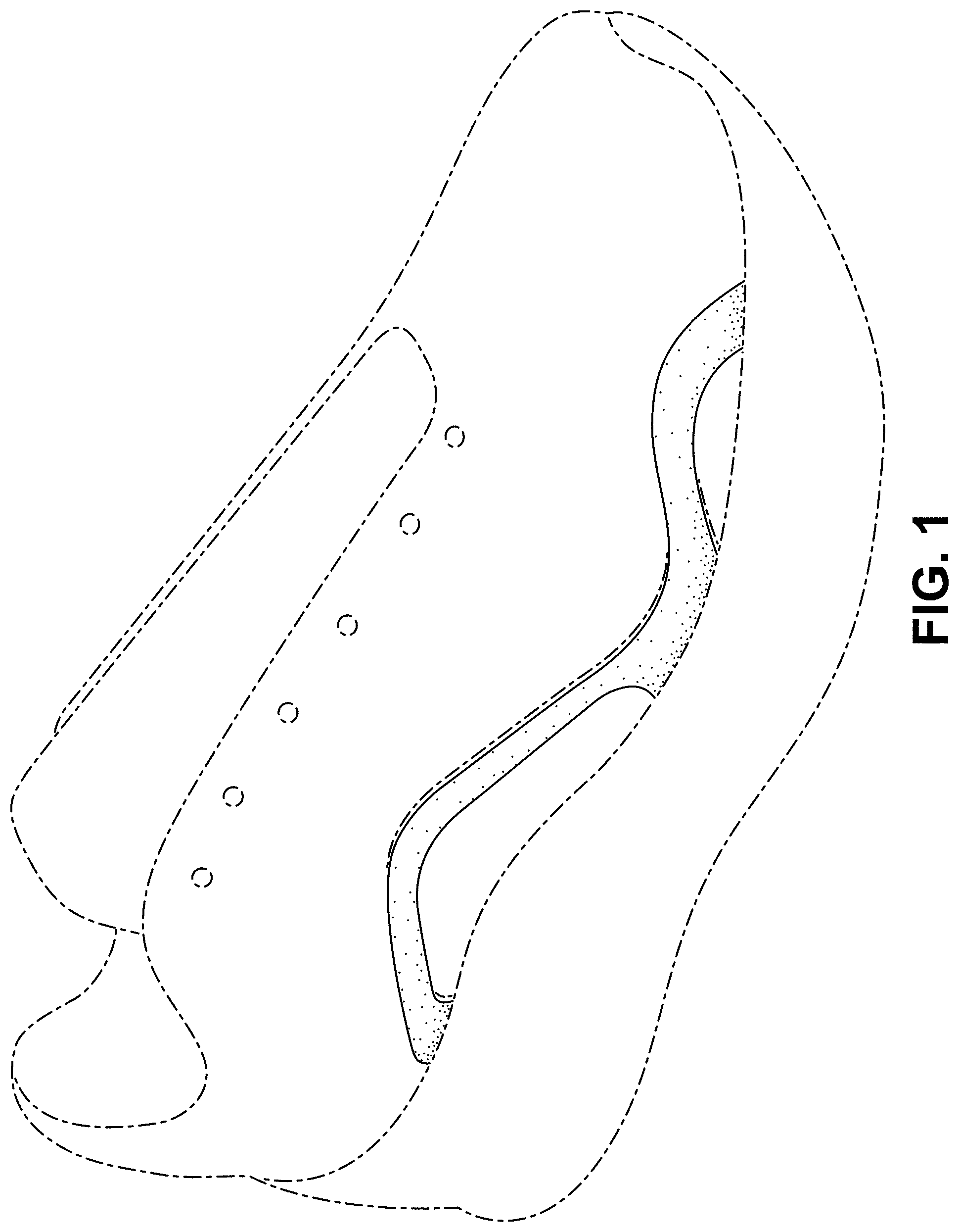 Patent USD1000049 Figure 1 – Shoe