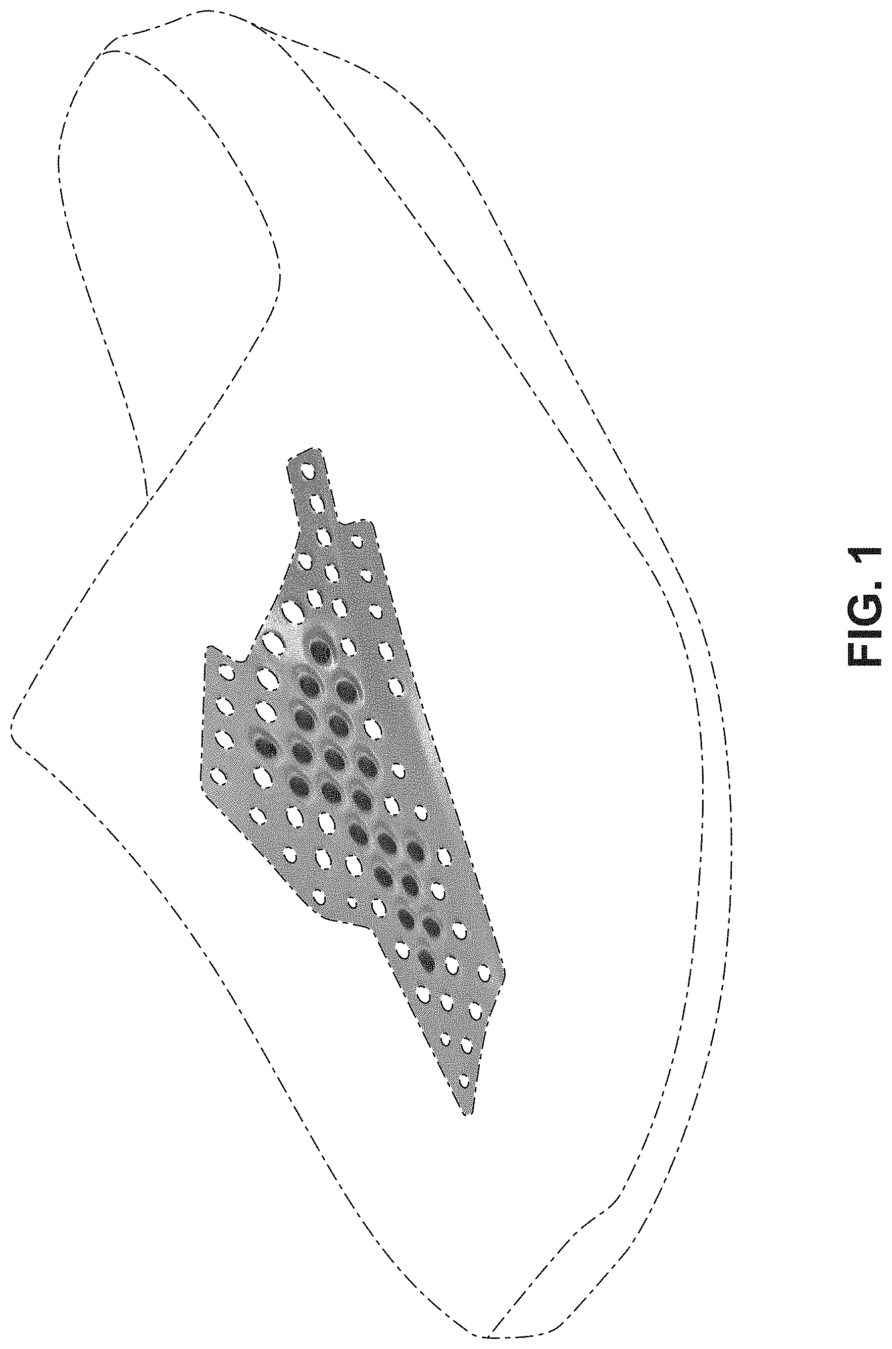 Patent USD1000091 — Shoe — Figure 1