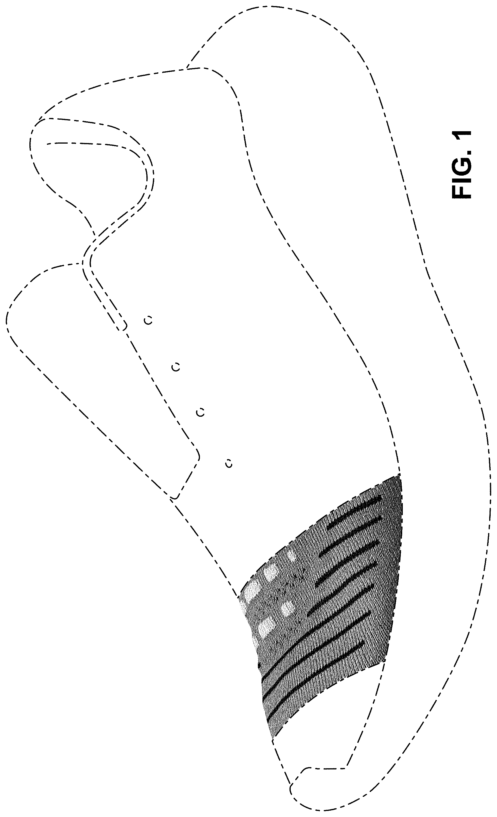 Patent USD1000099 — Shoe — Figure 1