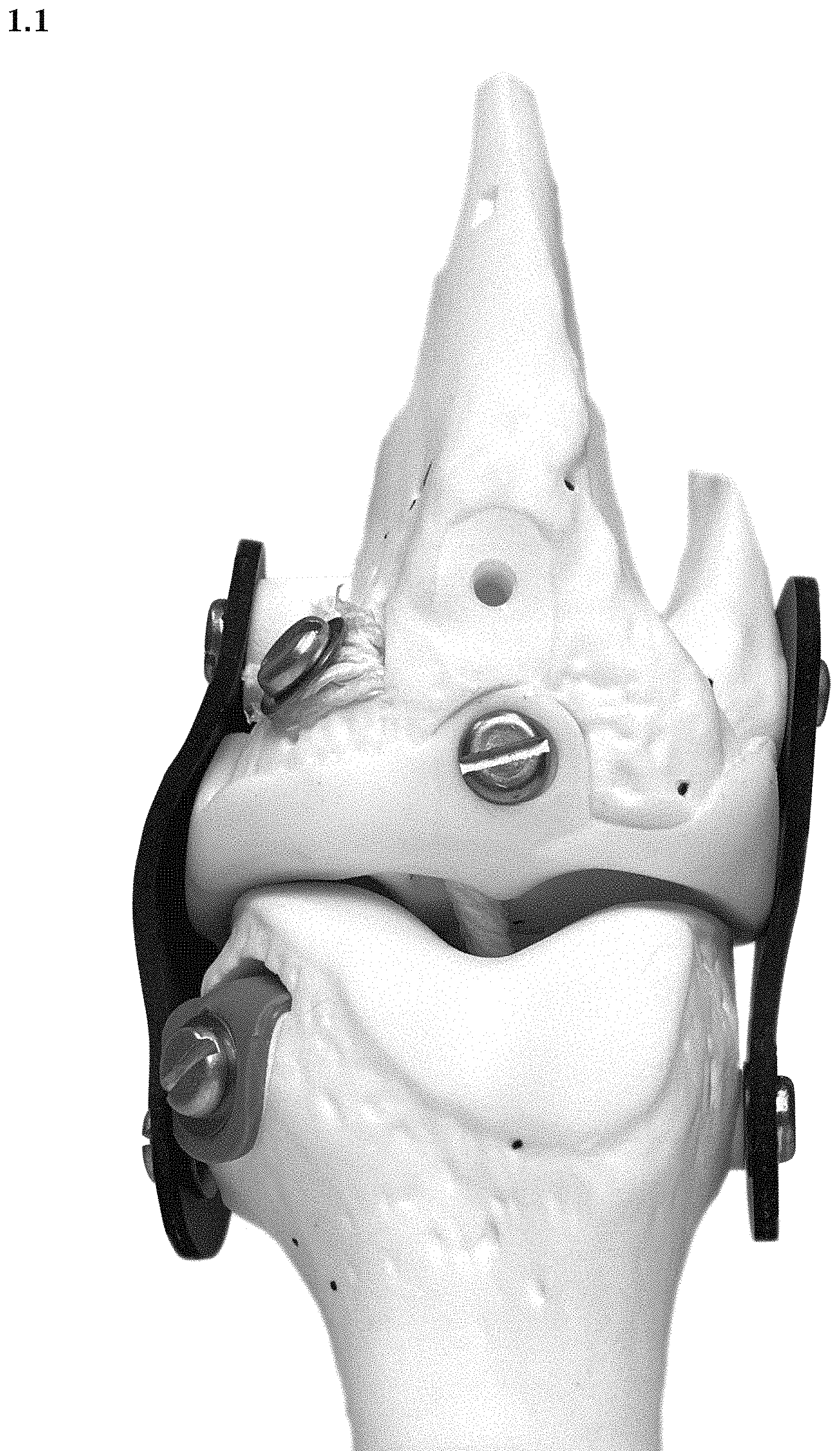 Patent USD1000614 — Artificial knee prosthetics — Figure 1