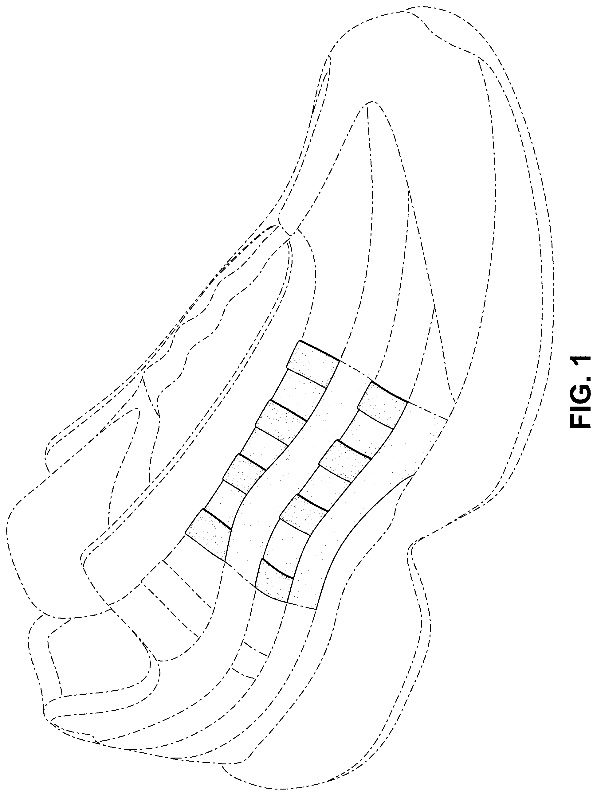 Patent USD1000815 — Shoe — Figure 1