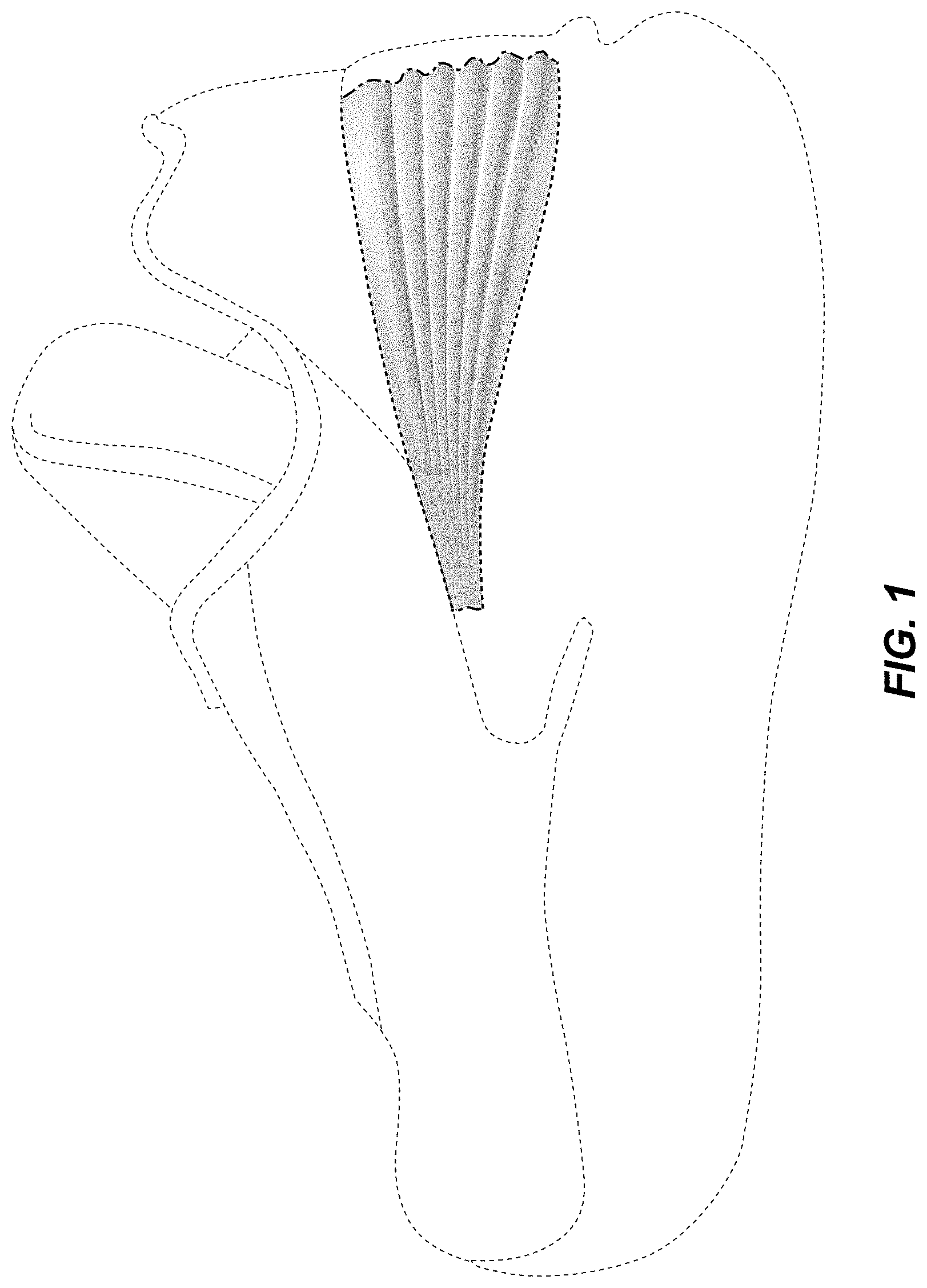 Patent USD1001464 — Shoe — Figure 1
