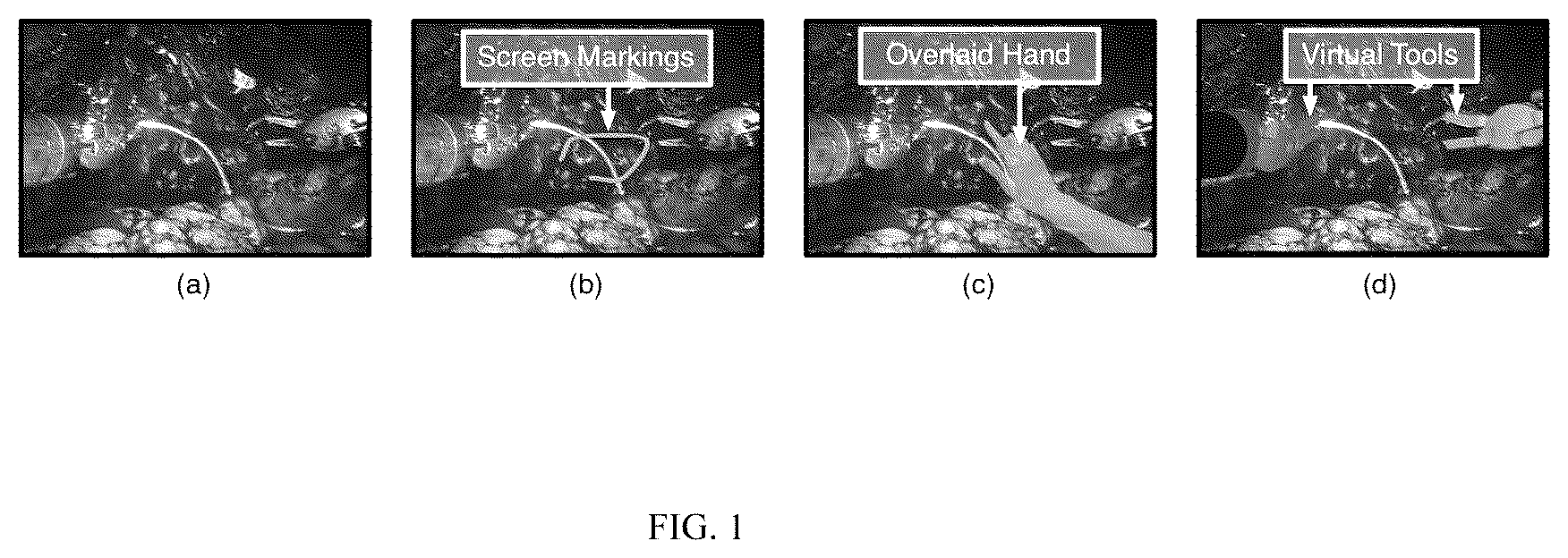 Patent US12090002 — System and methods for tele-collaboration in minimally invasive surgeries — Figure 1