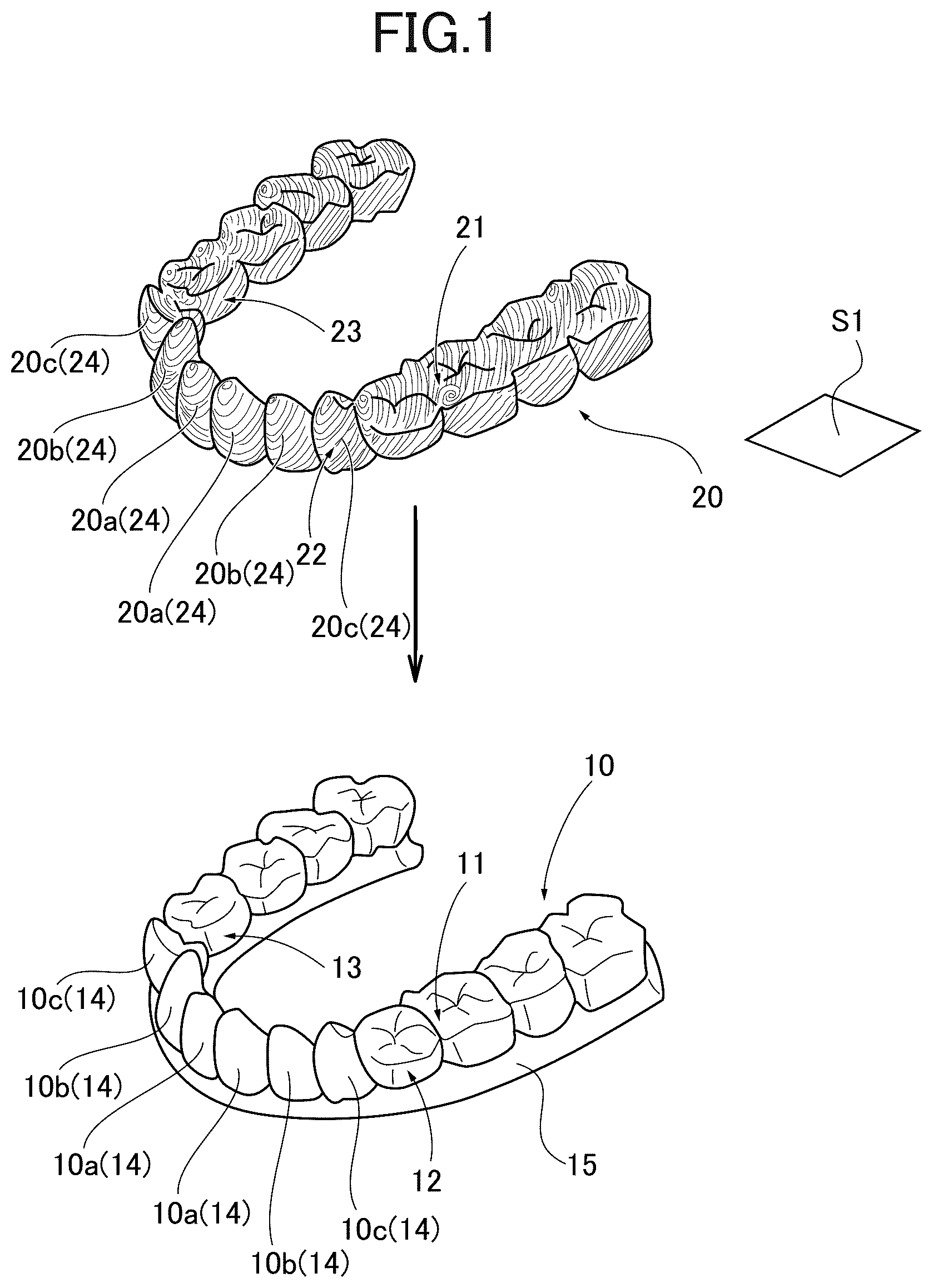 Patent US12090022 — Mouthpiece and mouthpiece manufacturing method — Figure 1